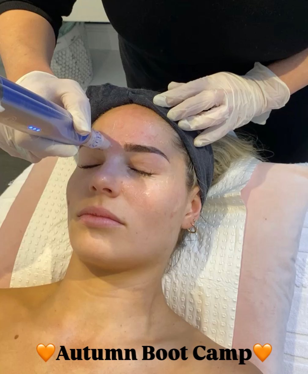 🧡Autumn Boot Camp🧡
- x4 Skin needling treatments
- x4 LED light therapy
- x4 Vitmain infusion with Galvanic machine
VALUED at $2236
NOW $1100
SAVE $1136