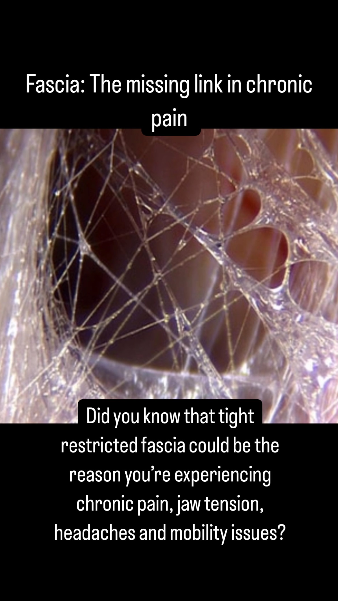 Fascia is the web-like connective tissue that surrounds every muscle, organ, and nerve in your body. When it becomes tight, dehydrated, or stuck, it can cause pain, tension, and misalignment that traditional treatments often overlook.
If you’ve tried chiropractic care, massage, or pain meds without lasting relief, Myofascial Release (MFR) may be the missing piece to your healing.
✔ Relieve TMJ tension, neck, back, pelvic pain, and migraines
✔ Improve posture and movement
✔ Release emotional and physical trauma stored in the body
Your body doesn’t have to live in chronic tension and discomfort. Let’s work together to restore movement and ease—naturally.
📍 Located in Santa Clarita, CA
📅 Book your 1:1 Myofascial Release session today!
Link in bio
#MyofascialRelease #FasciaHealing #TMJPainRelief #ChronicPainSolutions #SantaClarita #NaturalHealing