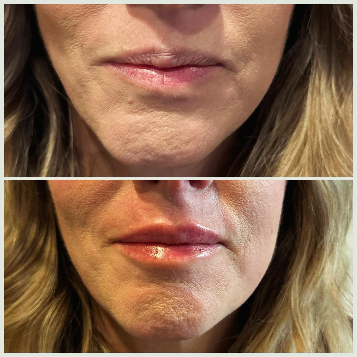 Before vs. after: When a little boost makes a big difference.