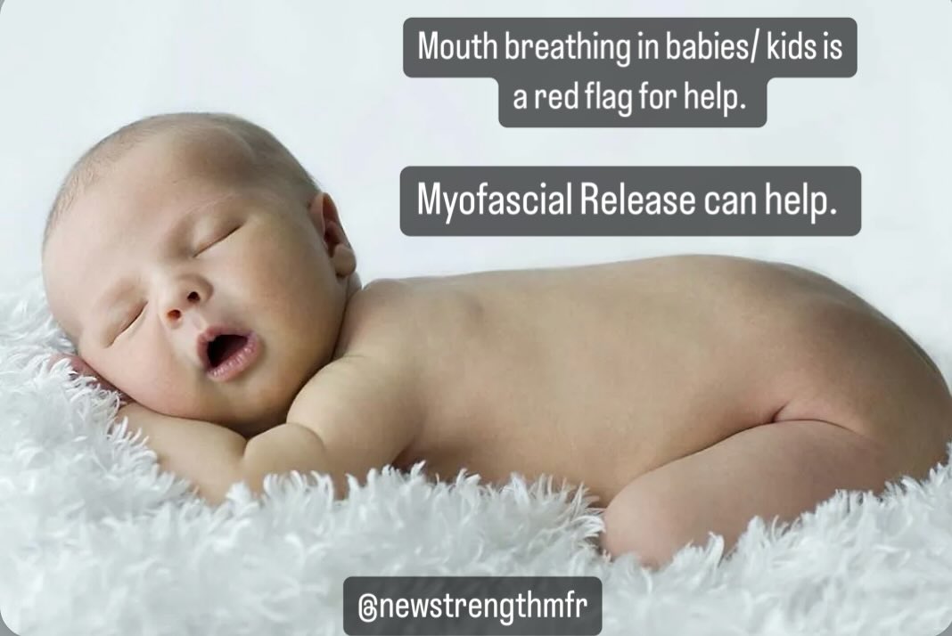 All babies are so precious! But if you happen to see a baby with their mouth open that’s a red flag and should be receiving early intervention.
Snoring is also a big red flag. It is an airway obstruction indicating airway blockage and could be related to a variety of factors like tongue tie, high narrow palate, structural issues, allergies/ congestion, or enlarge tonsils and adenoids.
We are so happy to help. Tight fascia around the mouth, checks, jaw, neck and throughout the whole body can restrict proper mouth closure.
Book your session today at www.newstrengthmfr.com
As mouth breathing may seem common, it is not normal. #occupationaltherapy #tonguetie #myofascialrelease #scvmoms #functionalairway