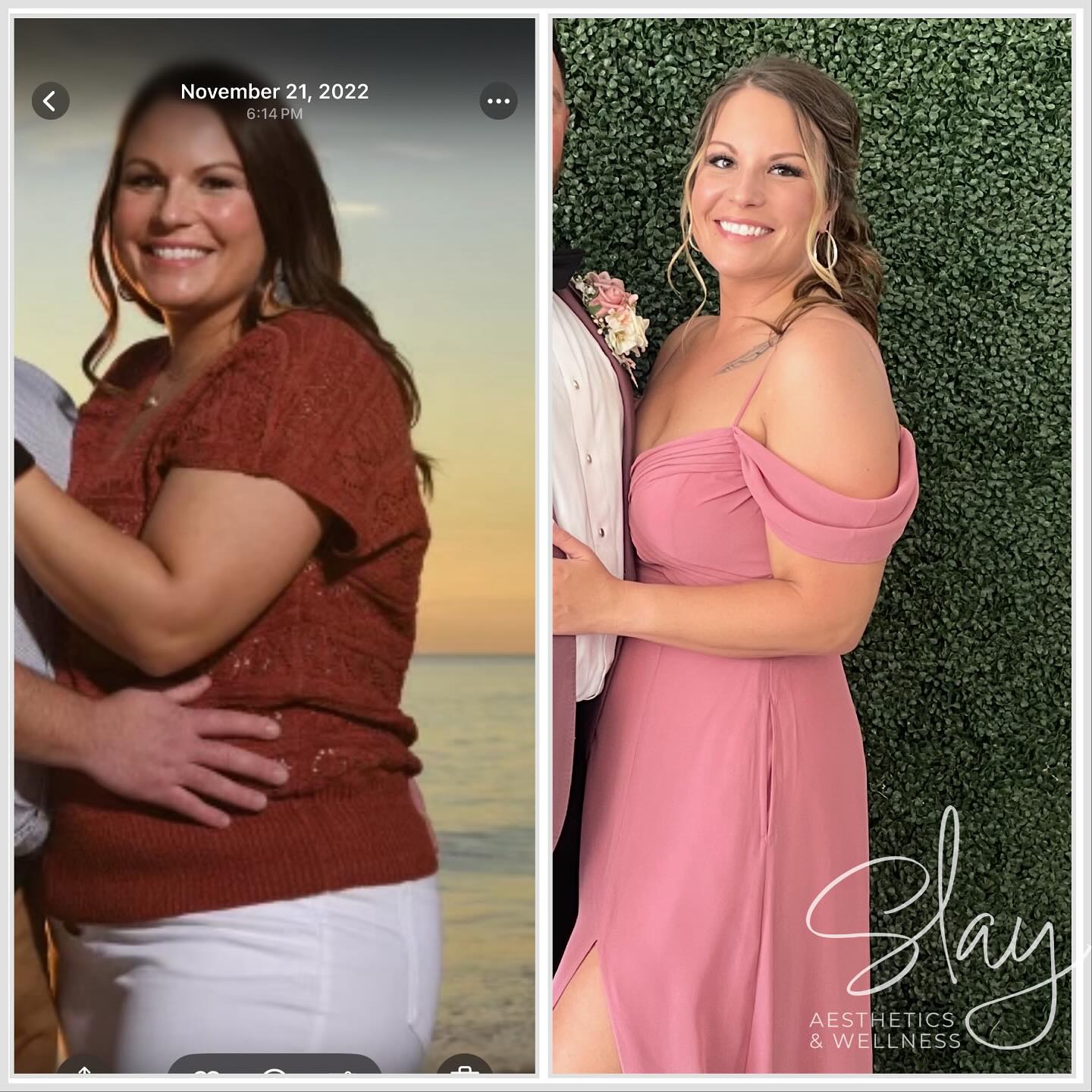 Summer is just around the corner, and it’s the perfect time to start your transformation journey! Imagine feeling confident, energized, and ready to shine in your favorite summer outfits. With our personalized weight loss program and the help of Semaglutide, reaching your goals is more achievable than ever. Don’t wait—take the first step today and let’s make this summer your best one yet!
#SummerBody #WeightLossJourney #SemaglutideSuccess #HealthyLiving #NewarkBotox#newarkweightloss#compoundedsemaglutide