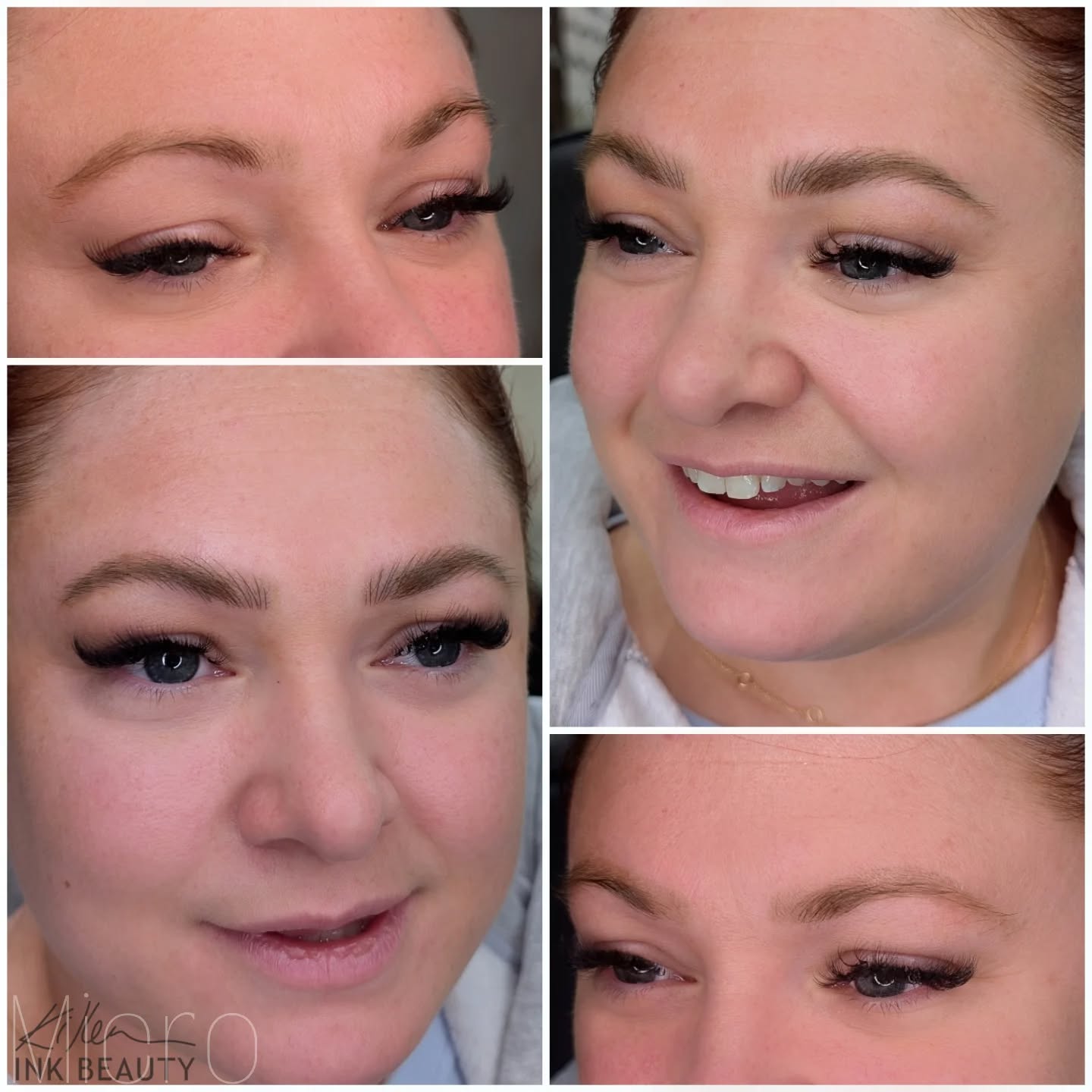 Obsessed is an understatement! Her brow correction turned out chef’s kiss and I’m just as in love with her gorgeous smile! 💕✨
.
.
.
.
#NanoBrows #MicrobladingYYC #CosmeticTattoo #BrowCorrection #BrowGoals #FlawlessFinish #HappyClient #YQCBrows #CalgaryBrows #PermanentMakeup #PMUArtist #PMUCanada #BrowTransformation #PowderBrowsYYC #OmbreBrows #NanoStrokes #BrowTattoo #NaturalBrows #BrowPerfection #CalgaryBeauty #YYCBeauty #YYCWomen #CalgaryMicroblading #YYCBusiness #BeautyInCalgary #BrowSpecialist #BrowLove #CalgaryAesthetics #BrowCorrectionYYC #KillenInk