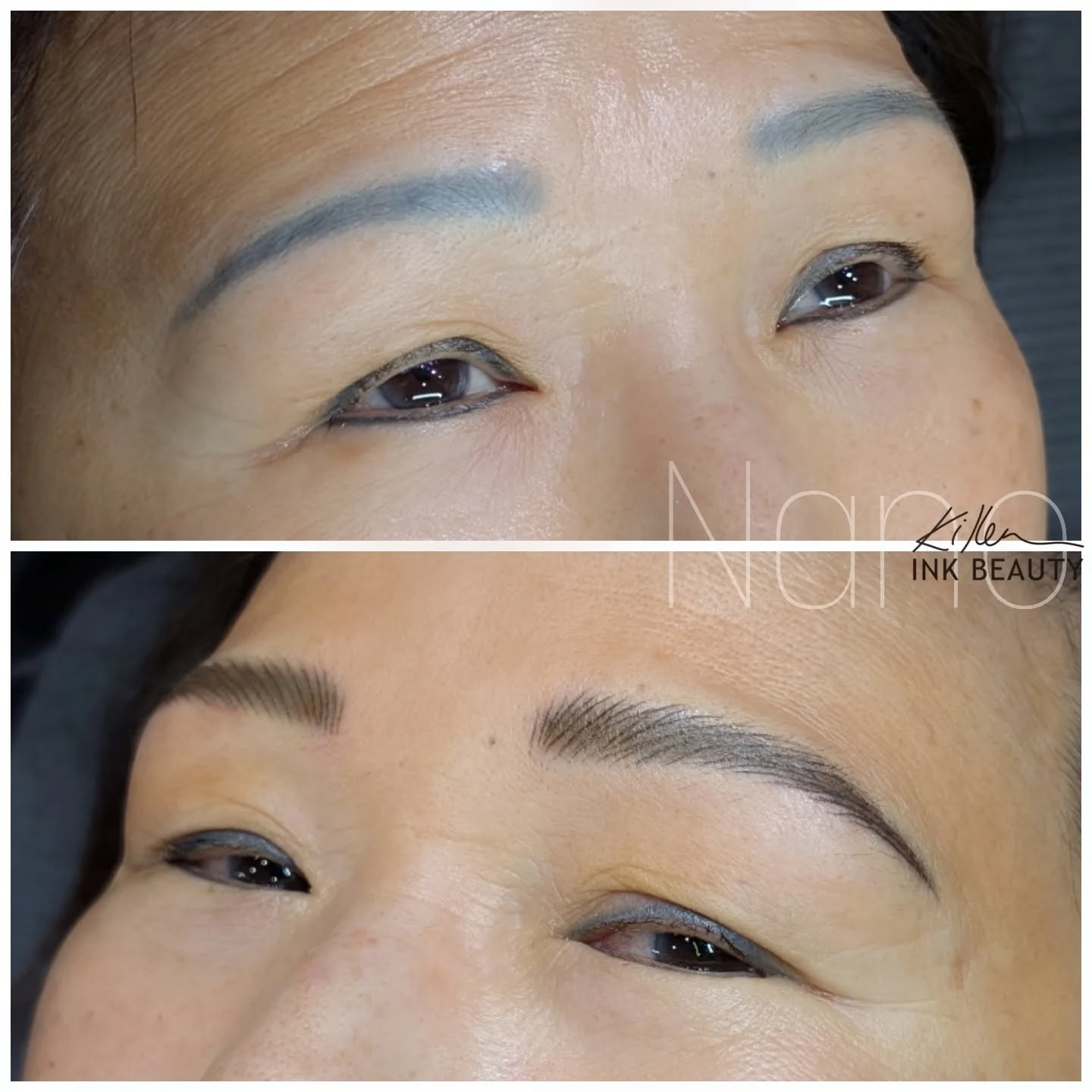 🪄Corrective brow magic in action!
Step 1: Neutralized and color-corrected the old blue faded tattoo using Honey Magic by Brow Daddy.
Step 2: Feathered in delicate nano strokes with the 0.30 mm Tina Davies pixel needle.
Step 3: Added soft nano shading between strokes to blur and blend the old work into a new, natural-looking brow.
The transformation is night and day — a fresh, dimensional brow built over the past.
What do you think of this correction? Would you have guessed there was an old tattoo underneath?
.
.
.
.
#CalgaryBrows #YYCBrows #YYCBeauty #YYCMicroblading #CalgaryMicroblading #Microblading #CalgaryBeauty #MicrobladingYYC #Brows #CalgaryTattoo #YYCNanoBrows #NanoBrows #BrowCorrection #PermanentMakeup #PMUArtist #BrowTransformation #NaturalBrows #CalgaryEyebrows #CalgaryEyebrowTattoo #OmbreBrows #BrowGoals #BrowGame #CosmeticTattoo #MicrobladingArtist #YYCLiving #YYC #BrowShaping #BrowGameStrong #PMUBrows