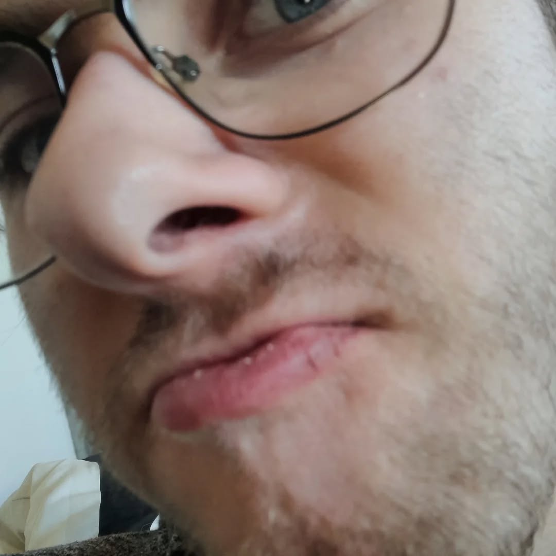 I could pretend to have a really interesting life by saying I've split my lip by getting in an insane fight which I won in some epic manner...
But I got dehydrated.
