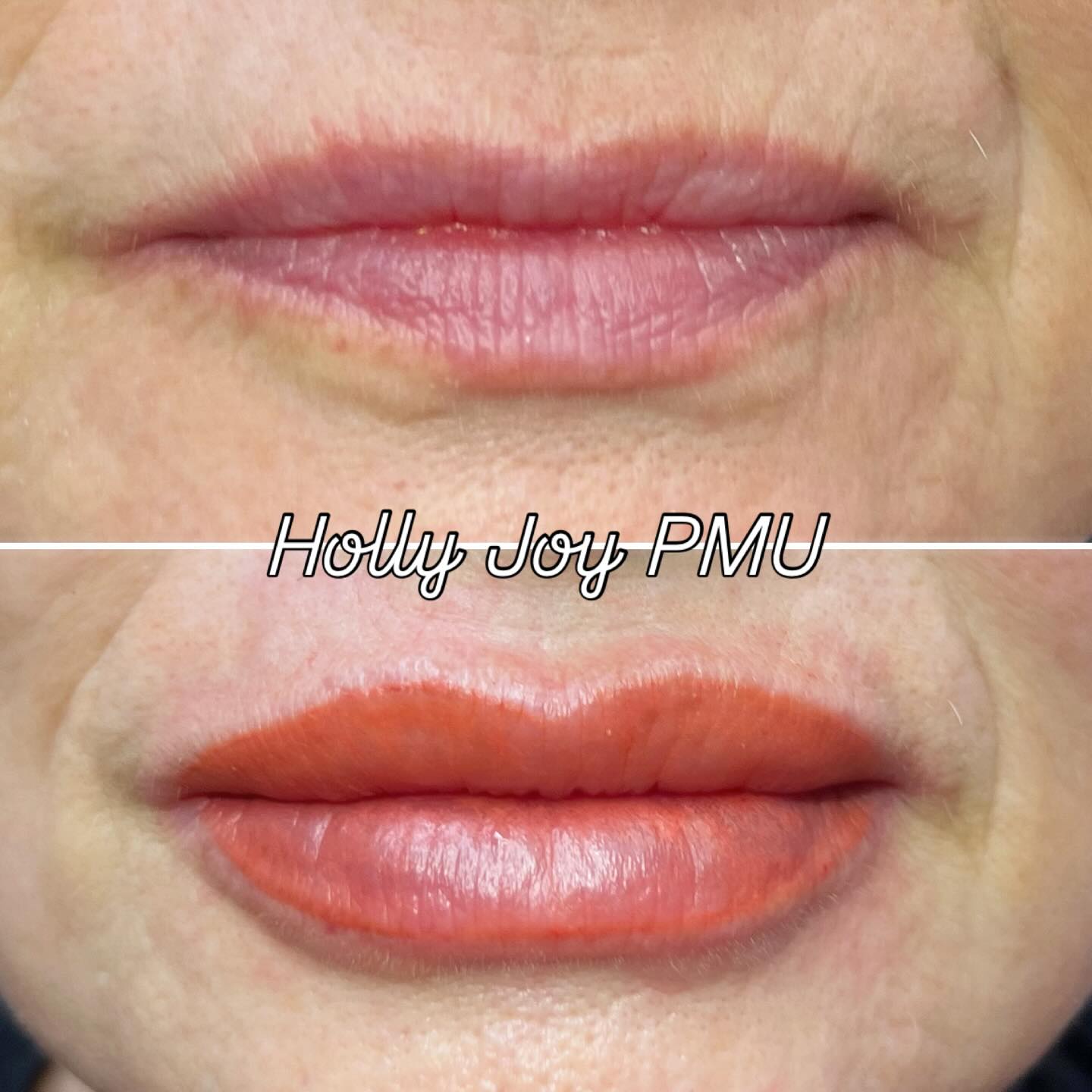 These lips will be ready for the pool parties!👄Healing takes 6-8 weeks, so don’t waste time getting yours started🤩#orangecrush #frenchfancy