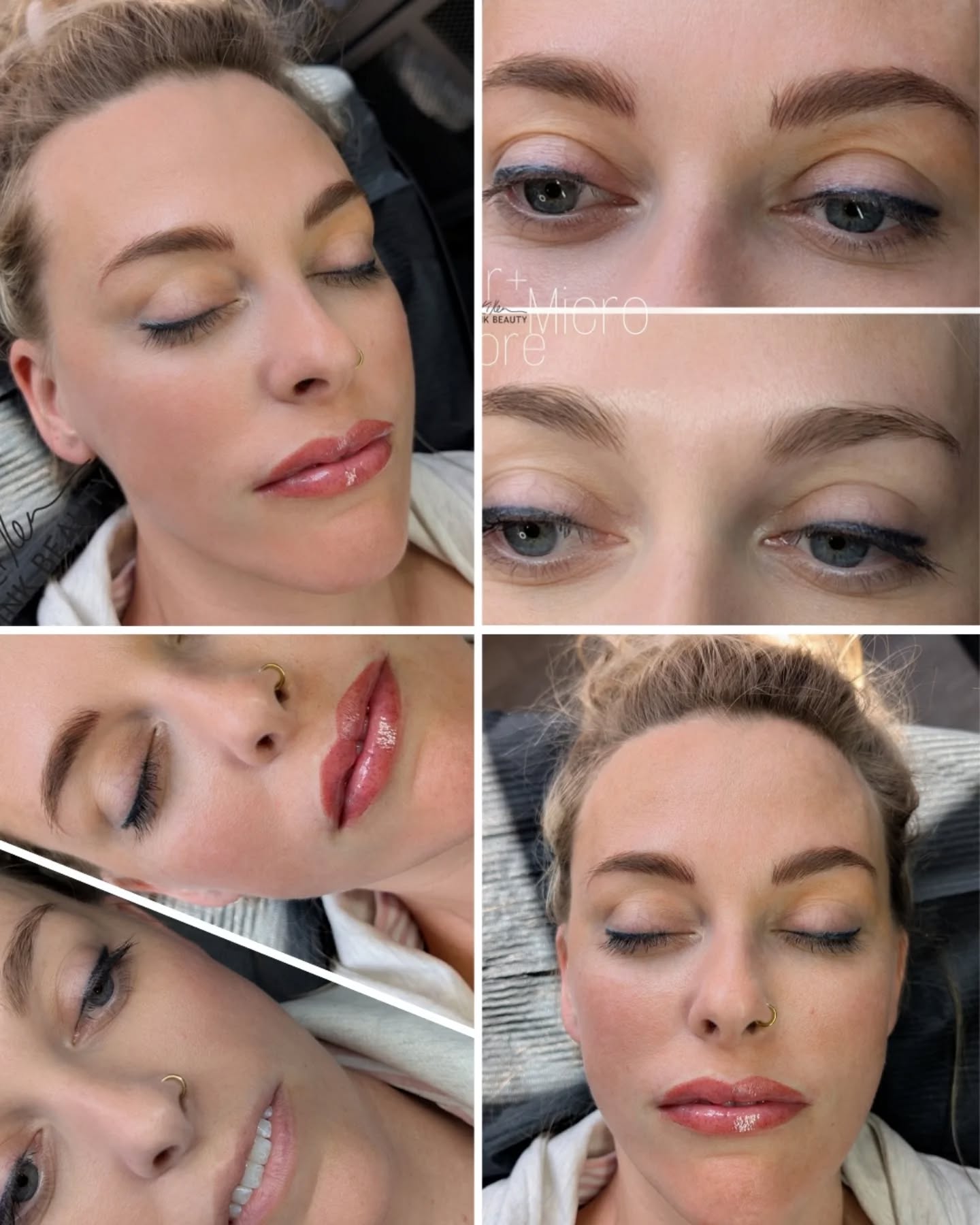 ❤️Combo day at the studio—lip blush + brows! Soft, natural, and enhancing her already gorgeous features.
#lipblushcalgary #microbladingcalgary #yycbeauty #calgarybrows #calgarylipblush #cosmetictattoocalgary #yycmicroblading #yyclipblush #naturalbrowscalgary #browtattoocalgary #yycpermanentmakeup #calgarypmu #softbrowsyyc #browartistcalgary #yycbrowartist #lipblushtattoo #browmakeupyyc #calgarymakeupartist #pmucalgary #calgarybeautystudio