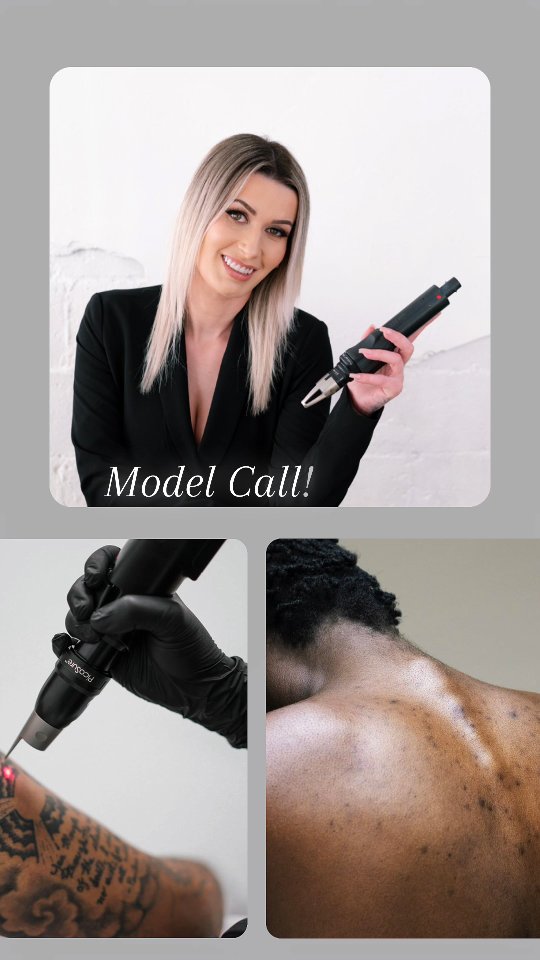 Model wanted: PicoSure laser !
✔️ In-Clinic PicoSure Laser Treatments
✔️ Model-Exclusive Savings on Services
✔️ Treatments by Experienced Professionals
✔️ Highly Rated with Outstanding Results
Comfort with photography and filming for online content is required.
Ready to transform your skin?
Send a DM to express your interest.