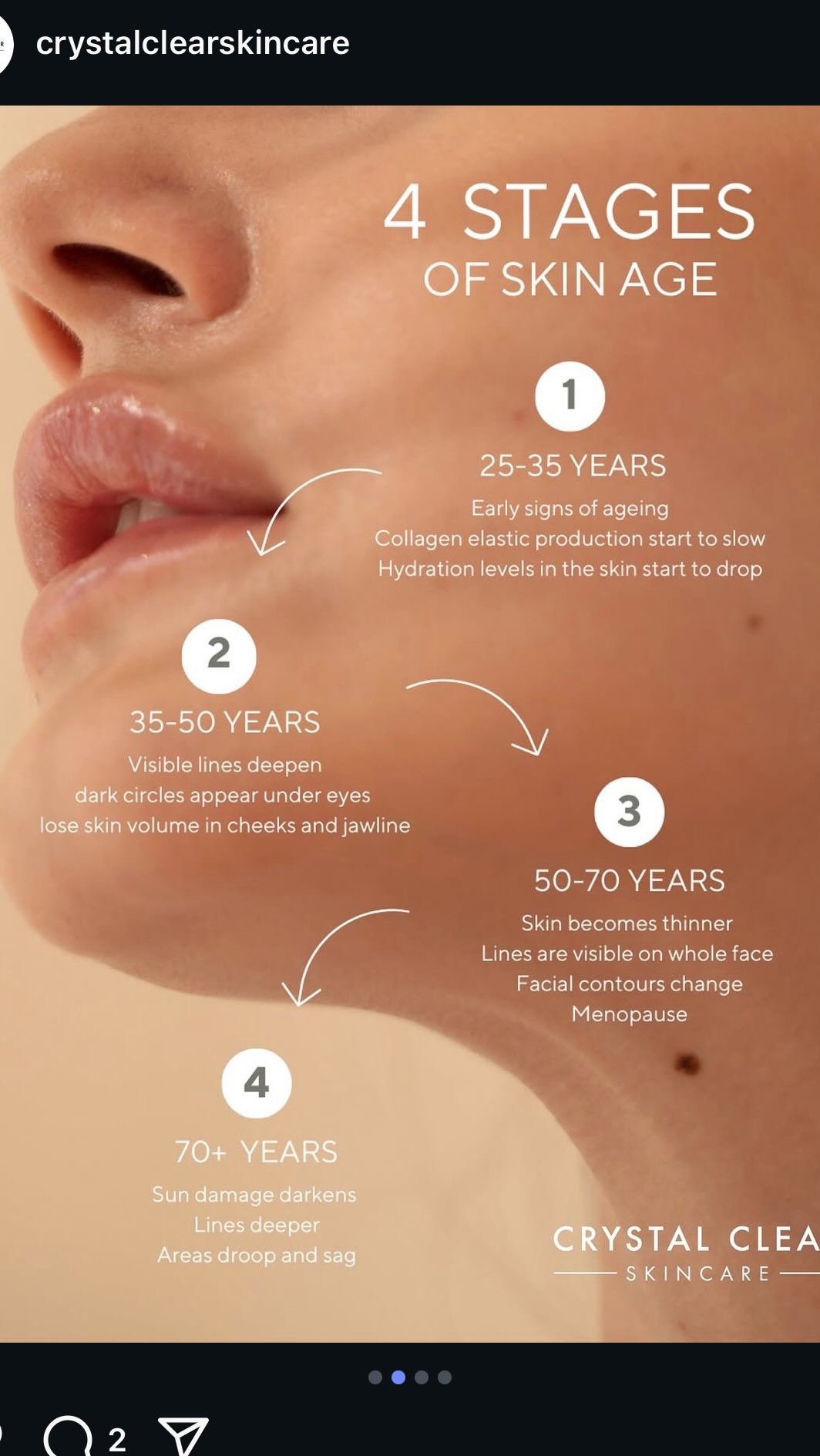 Mother's Day Giveaway!!
We are offering 5 Crystal Clear Storm Facials for £100 (normally £150)
5 Resurface, Heel and Peel Facials for £70 (normally £90)
To be purchased on voucher and used within 6 months. Will be available to purchase from the salon 18/3/25. Only one voucher per person.
#crystalclearskin #skin #crystalclearstorm #facials #skincare #skincareroutine #naturalfacelift #beauty #glowingskin #mothersdaygift