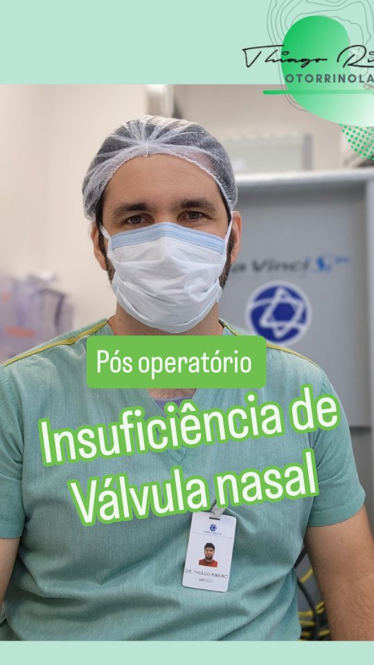 👉 A insuficiência de válvula nasal ocorre quando a estrutura da válvula nasal (a parte mais estreita das vias aéreas nasais) não consegue manter um fluxo de ar adequado, causando dificuldade para respirar pelo nariz ao respirar.
👉 Isso pode ser causado por fraqueza ou colapso das cartilagens nasais, sequelas de cirurgias anteriores, inflamações crônicas ou alterações anatômicas.
👃Sintomas
📌 Sensação de nariz entupido sem obstrução aparente
📌 Respiração nasal difícil, especialmente ao inspirar
📌 Piora ao esforço físico ou ao deitar
Causas Comuns
👉 Rinoplastia mal planejada ou agressiva
👉 Fraqueza natural das cartilagens nasais
👉 Envelhecimento
Tratamento
📌 Conservador: Uso de dilatadores nasais externos (como o "Respire Melhor")
📌Cirúrgico: Implante de enxertos cartilaginosos para reforçar a estrutura nasal - como no caso citado
É importante avaliar caso a caso é identificar a causa da obstrução nasal para conseguir resolver com precisão o problema!
👉👉👉 Como está sua respiração aí?
👇👇Comente nos comentários!!! Tem alguma dívida?
O que acharam?
" NOSSO COMPROMISSO É MELHORAR SUA QUALIDADE DE VIDA"
📌Dr. Thiago Ribeiro de Almeida
CRM-SP 180.753/ RQE 88820
Especialista em doenças do nariz
🎈 Rinologista pela Unifesp
🎈 Otorrinolaringologista pela Unisa
🎈 Médico pela UFJF
🎈Título de especialista pela sociedade brasileira de Otorrinolaringologia
@brooklinindica @maisbrooklin @brooklin_recomenda
#narizperfeito #respiração
#drthiagoribeirodealmeida