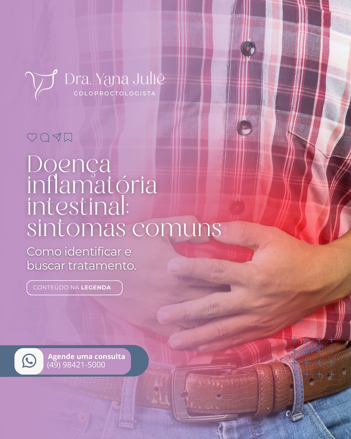 ‼️Você sabia que o mês de Maio é dedicado a conscientização das Doenças Inflamatórias Intestinais…
Sim, Maio Roxo🟪, tem como objetivo alertar sobre a importância do diagnóstico precoce, uma vez que as Doenças Inflamatórias Intestinais (Doença de Crohn e Retocolite ulcerativa) atingem mais de 5 milhões de pessoas em todo o mundo, e no Brasil, o número de casos vem aumentando consideravelmente.
Então, quais são os sintomas comuns:
🟣 Dor abdominal, diarreia crônica, sangramento nas fezes e perda de peso podem ser sinais de doenças inflamatórias intestinais, como a doença de Crohn e a retocolite ulcerativa.
🚨
Essas condições necessitam de diagnóstico precoce e
acompanhamento especializado para evitar complicações e melhorar a qualidade de vida.
✋O proctologista é o profissional que pode ajudá-lo a compreender os sintomas e iniciar o tratamento adequado. 🌟
👉Sente alguns desses sintomas? Agende uma consulta e cuidado da sua saúde intestinal com quem entende do assunto!
#DoençaInflamatóriaIntestinal #Proctologia #proctochapeco #chapecó #proctologistachapeco #SaúdeIntestinal
#Prevenção #CuidadoComSaúde