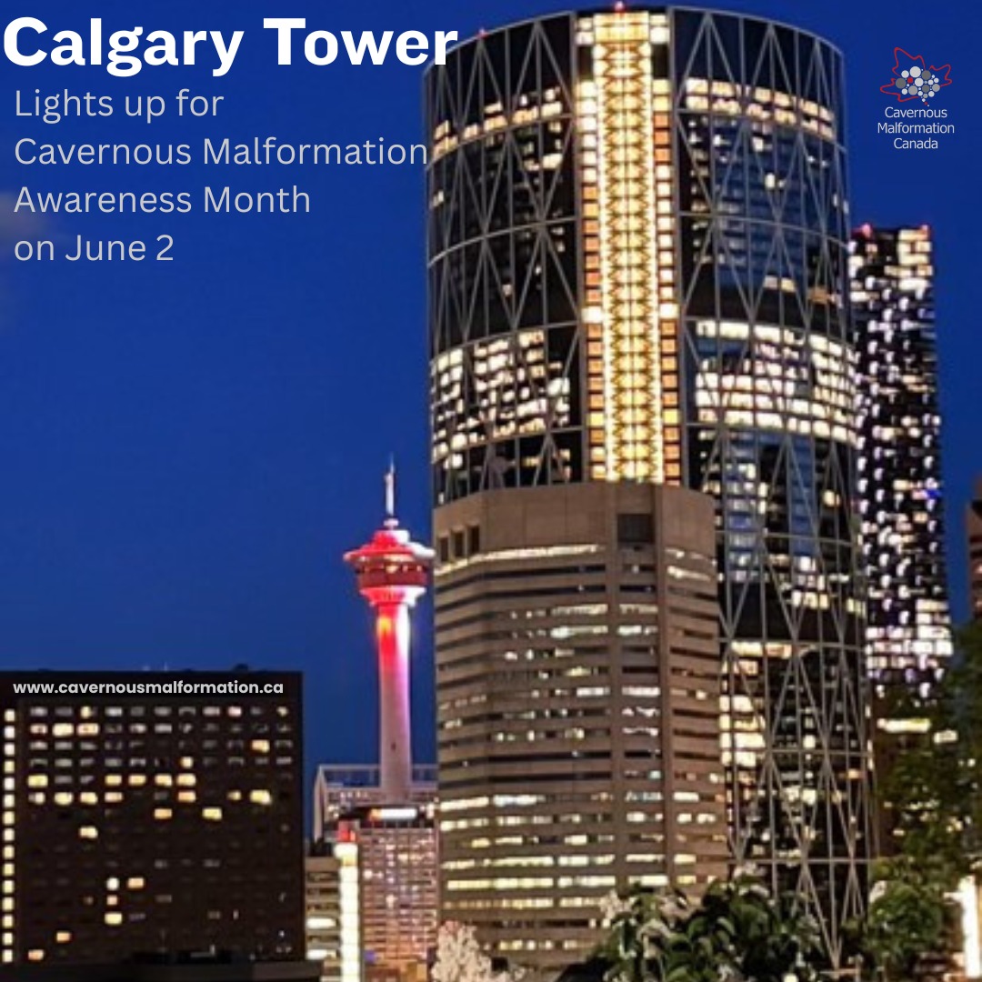The @calgarytower ignites awareness of Cavernous Malformation on June 2.
Illuminating with a light show in red just before sunrise and again at dusk to midnight, the Calgary Tower is a historic landmark on the Calgary landscape.
Our community is recognized as we come together to bring attention to the need for research, treatment options and a cure.
Viewing Locations:
1. Centre Street and 9th Ave SE (Downtown)
2. Tom Campbell's Hill Natural Park-(Renfrew)
3. Scotsman's Hill-(Ramsay)
4. Murdoch Park (Bridgeland)
5. Bow River Pathway (near Centre street bridge)
6. McHugh Bluff (Crescent Heights)
7. East Village, along 9th Ave
Tag us in your photos or send them to contactus@cavernousmalformation.ca
Other Lightings this week:
June 1-7 Barrie Heart Sign, Barrie, ON
June 5 Peterborough City Hall, Peterborough, ON
Thank you @calgarytower for helping us during Cavernous Malformation Awareness Month! Your support brings hope and helps us to honour the experience of cavernous malformation patients everywhere.
📷 @kailleyk
#ignitingawareness #lightupforcavernousmalformation #cavernousmalformation #cavernoma #calgary #yyc #barrie #peterborough #raredisease