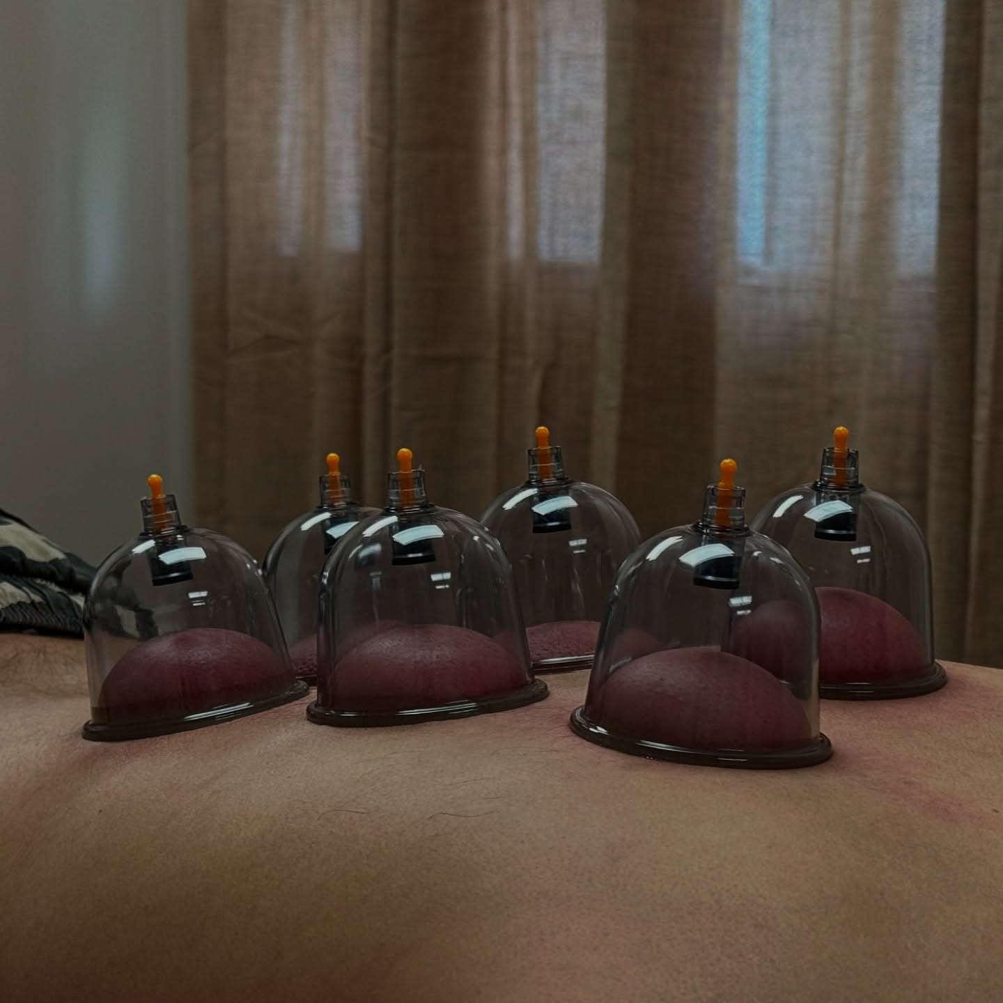 No fire, just air — same healing power. Relax, reset, and let the suction do its magic.