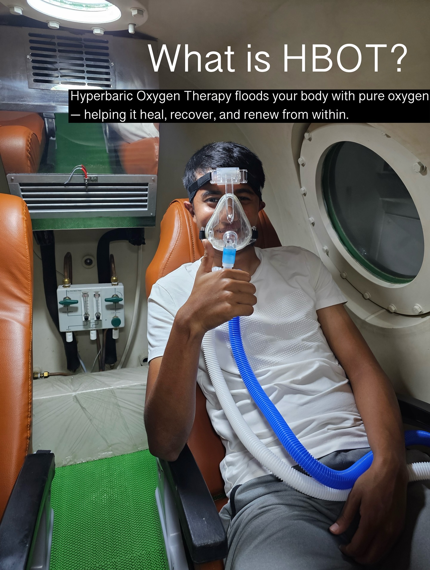 Can healing be as simple as breathing?
With Hyperbaric Oxygen Therapy (HBOT) - yes.
Inside a pressurized chamber, your body absorbs 100% pure oxygen - far more than it ever could at normal levels. That extra oxygen fuels healing, reduces inflammation, supports brain function, and helps your body do what it was designed to do: recover.
✨ Skin, brain, muscles, immunity - HBOT helps all of it.
✨ From chronic pain to post-surgery recovery, even mood and focus - oxygen is your quiet superpower.
And now, you can try it in Goa’s first immersive HBOT chamber.
Just breathe. Your body will handle the rest.
#HBOT #OxygenTherapy #HyperbaricHealing #GoaWellness #PeakRecovery #SkinHealing #BrainHealth #NaturalHealing #FutureOfWellness #healingfromwithin