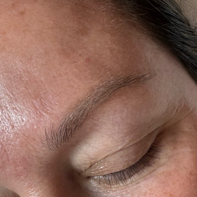 Healed eyebrows after one session #dva #hairshanghai #hairchina
