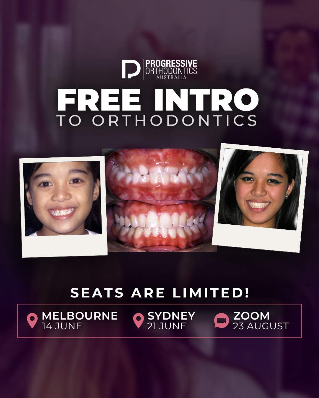 Come experience our Free Intro to #Orthodontics classes and try out our brand-new curriculum that includes brackets, aligners, and hybrid treatment. Earn 4 free CPDs (2 CPDs online) and learn about the benefits that ortho can bring to your practice.
Registration:
✉️ Zita@POSOrtho.net
☎️ +61 402 314 528
.
#OrthoEducation #DentalEducation