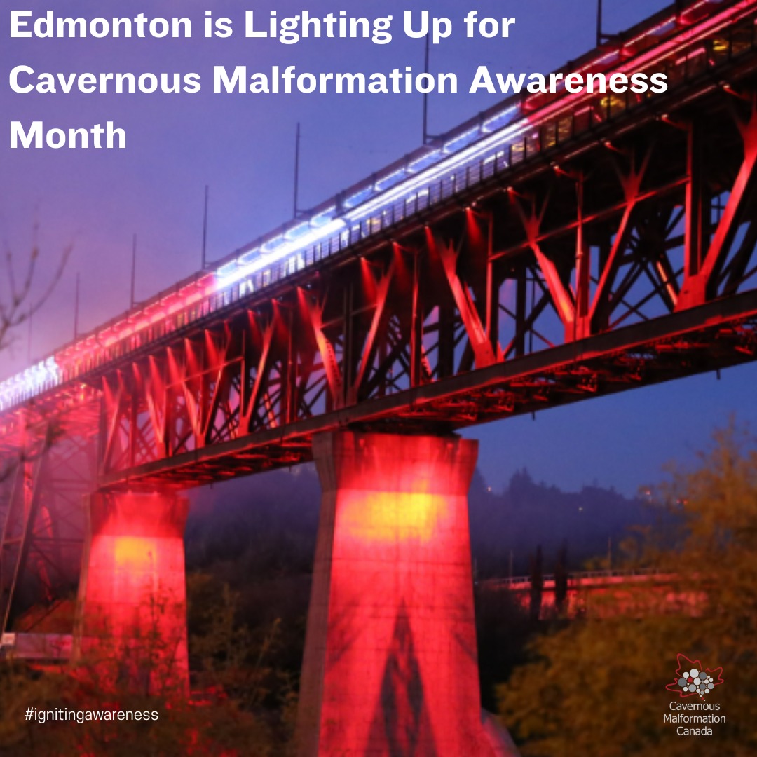 On June 18, our home city is illuminating for Cavernous Malformation Awareness Month!
High Level Bridge
Alberta Legislature Building
Fairmont MacDonald Hotel
Will light the city in red and red, white and gray. Alberta has declared June as Cavernous Malformation Awareness Month!
As a rare disease, patients and families experience barriers and challenges that impact their care and quality of life. Lighting landmarks brings a sense of community, recognition and momentum towards a cure for cavernous malformation and curiosity from people to learn, get involved and we hope, understand.
Join us at our Community Meet Up @fairmontmac June 18 at 8:45pm to share, connect and watch our capital city ignite awareness, reminding us, we are not alone.
Other lighting taking place this week:
June 20 RBC Centre Winnipeg
June 21 Vaughn City Hall
>>
Le 18 juin, notre ville s'illumine pour le Mois de la sensibilisation aux malformations caverneuses !
Pont High Level
Palais de l'Assemblée législative de l'Alberta
Hôtel Fairmont MacDonald
La ville s'illuminera de rouge, de blanc et de gris. L'Alberta a déclaré juin Mois de la sensibilisation aux malformations caverneuses !
Les malformations caverneuses étant une maladie rare, les patients et leurs familles sont confrontés à des obstacles et à des défis qui ont une incidence sur leurs soins et leur qualité de vie. L'illumination de monuments historiques suscite un sentiment de communauté, une reconnaissance et un élan vers un remède contre les malformations caverneuses, ainsi qu'une curiosité pour apprendre, s'impliquer et, nous l'espérons, comprendre.
Joignez-vous à notre rencontre communautaire @fairmontmac le 18 juin à 20 h 45 pour partager, tisser des liens et voir notre capitale éveiller les consciences, nous rappelant que nous ne sommes pas seuls.
Autres illuminations cette semaine :
20 juin, Centre RBC de Winnipeg
21 juin, Hôtel de ville de Vaughn
#cavernousmalformation #alberta #edmonton #cavernoma #ignitingawareness #cavernousmalformationawarenessmonth