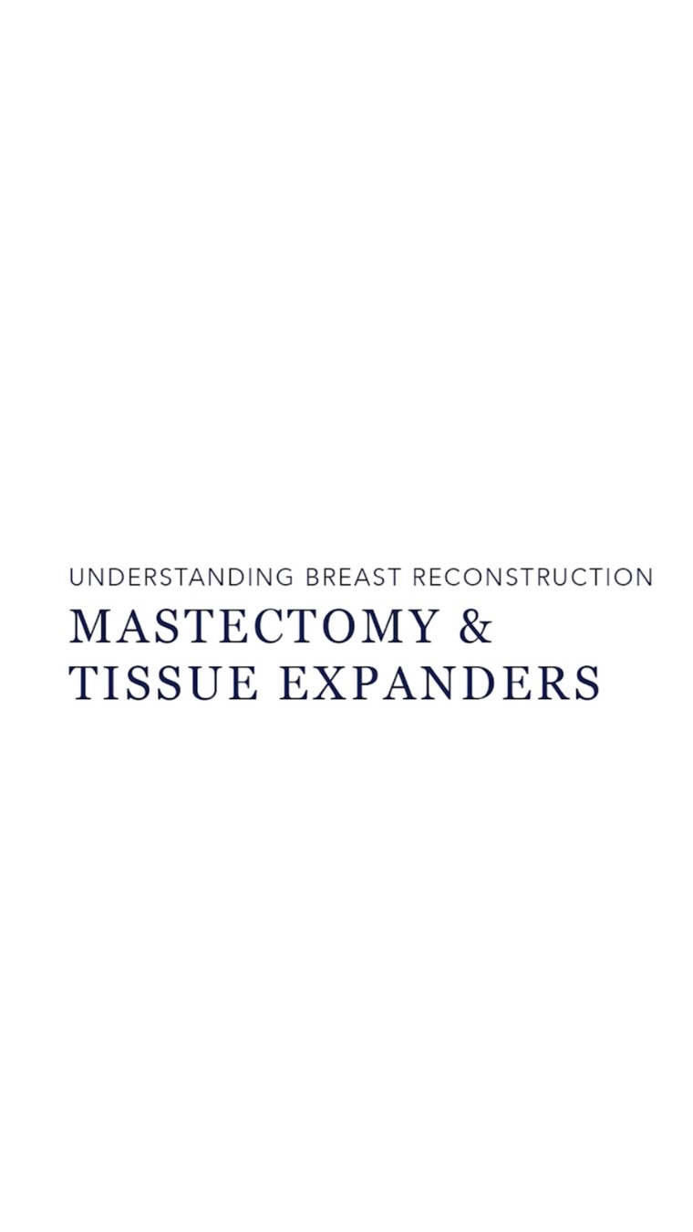 Mastectomy and Tissue Expanders. Visit the link in bio for full video: https://www.drduncantaylor.com.au/breast-reconstruction-videos.  Dr Duncan Taylor (MED0001883464) Specialist Plastic & Reconstructive Surgeon.
🔹There are inherent risks associated with any surgical or invasive procedures. The recovery period varies based on the specific procedure, and individual outcomes will differ.
🔹More information about risks and recovery for each procedure is available on our website www.drduncantaylor.com.au, on the procedure information sheets.
🔹We recommend getting a second opinion from a qualified health practitioner before proceeding.
#breastreconstruction #breastreconstructionsurgeon #breastreconstructionawarenes #breastreconstructionjourney #perthbreastreconstruction #breastreconstructionperth #breastcancerperth #perthbreastcancer #specialistplasticsurgeon #tissueexpanders #implantbasedreconstruction