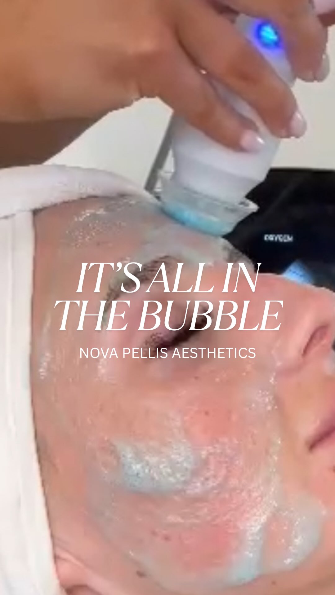 💨Hydra Oxygenation: Oxygen for Glowing, Radiant Skin✨
Let your clients experience the power of science backed skincare.
Our Nova Hydra Oxygenation treatment draws oxygen into the skin to boost circulation, cell renewal, and give a natural glow.
What to Expect:
✨Minute CO2 bubbles form on the skin during treatment
✨This gentle reaction stimulates oxygen flow and enhances absorption of active ingredients
✨The result? Smoother texture, brighter tone, and a visibly younger, Fresher complexion
Perfect for full, tired, or dehydrated skin in need of a revitalising boost.
Get in touch with our team and learn more about our Nova Hydra Facial Device. Affordable consumables help you increase your revenue. Book a demo by visiting our website.
🌐www.novapellisaesthetics.com
📩info@novapellisaesthetics.com
📱0800 009 6397
📱WhatsApp 07497 831533
#novahydra #oxyfacial #oxygenationfacial #hydratedskin #glowingskin #exfoliation #facial #fridaymotivation #skinrenewal #glowup #clinicowners #salonowners