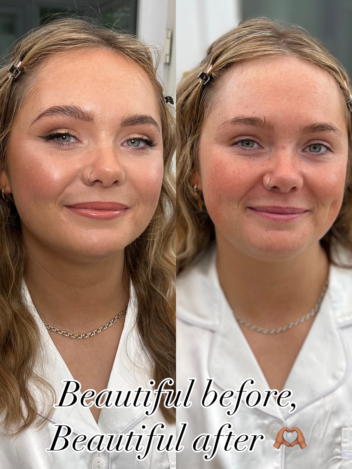 Mrs Lightning⚡️
Ohhh Maddie, where do I even begin 🥹
You are the sweetest soul! Thank you so much for choosing me as your bridal make up artist, it was truly a pleasure 🫶🏽
Maddie wanted to keep her bridal glam soft, fresh and true to herself, allowing her gorgeous freckles to shine through.
We focused on glowing skin, soft definition and enhancing her natural features and wow, didn’t she look incredible!
There’s no one size fits all when it comes to bridal makeup. Whether your after a barely there beauty or a full glam, I work closely with each bride to create a look that feels unique to you.
2026 Dates are starting to fill up fast.
DM or enquire via my email (link in bio) to reserve your date 🤍
#naturalbridalmakeup #2026bride #bridalbeforeandafter #naturalbridallook #bridalmakeuptransformation #dorsetbridalmakeup @maddiesinabox