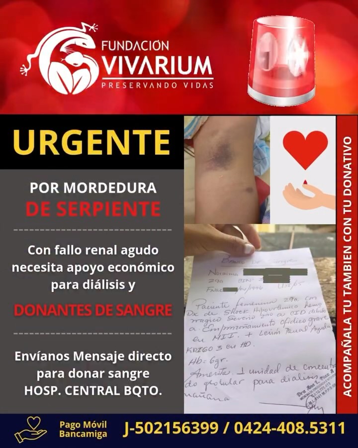 🆘 Moraima, lucha por su vida tras una mordedura de mapanare.
Presentó shock hipovolémico y coagulación intravascular diseminada, complicaciones severas que la mantienen en hemodiálisis. Su hemoglobina apenas subió a 6 g/dl.
Necesita donantes de sangre y apoyo económico urgente.
Desde Fundación Vivarium la estamos acompañando en este momento crítico.
🙏 Tu ayuda puede marcar la diferencia. Dona, comparte, apoya.
Bancamiga 📲 Pago Móvil:
J-502156399 / 0424-408.5311
Cta Ahorro : 0172-0201-49-2015105170
Cta Divisa: 0172-0201-40-2015099894
#AyudaParaMoraima #AccidenteOfídico #FundaciónVivarium #EmergenciaMédica #DonarSalvaVidas #SueroAntiofídico #SolidaridadQueCura #SaludVenezuela
#preservandovidas #envenenamientoofidico #ayudahumanitaria #snakeenvenoming