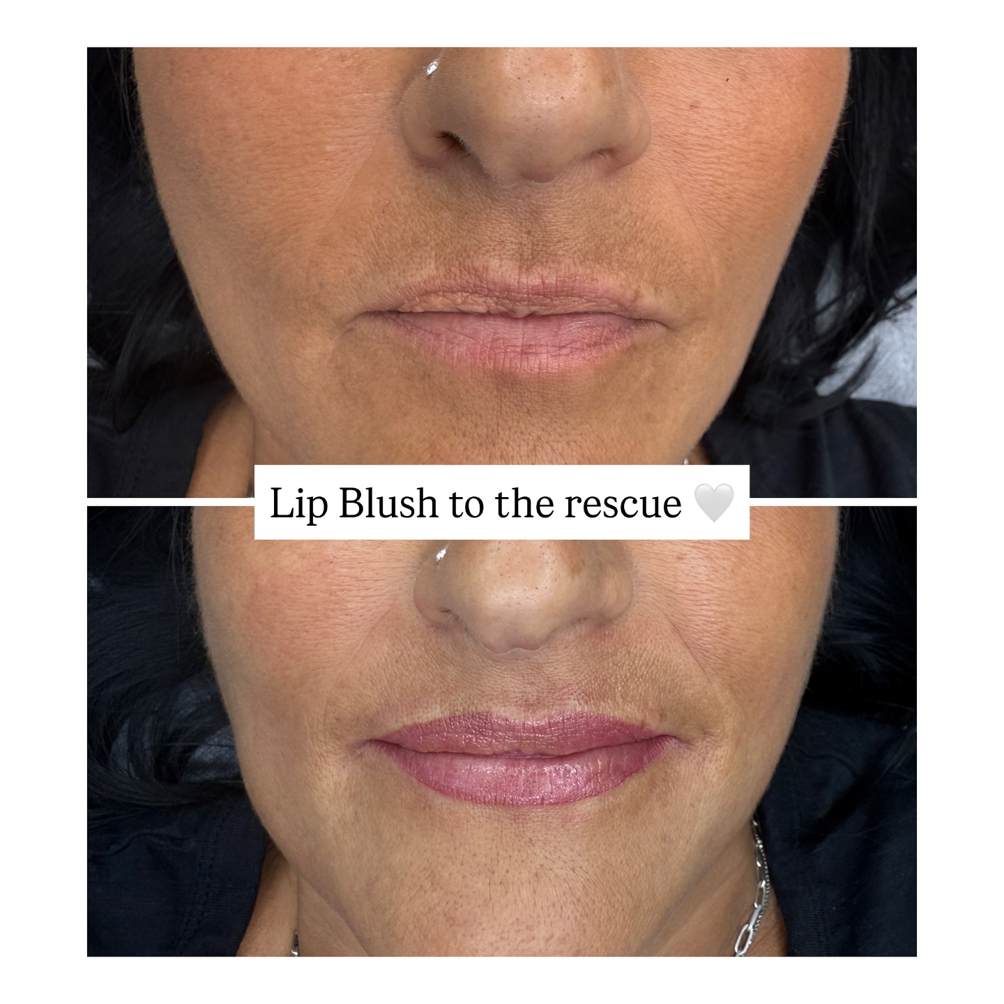 Elevate your beauty routine with our Lip Blush service! 💋✨ Say goodbye to daily lipstick application and hello to effortlessly gorgeous lips. Our semi-permanent makeup enhances your natural lip color, giving you a soft, youthful look that lasts. Perfect for busy lifestyles or anyone wanting to simplify their beauty regimen!
Benefits of Lip Blush:
1. **Long-Lasting Color:** Enjoy beautifully tinted lips for years without the hassle of reapplying lipstick.
2. **Natural Look:** Achieve a soft, natural finish that enhances your lips’ shape and color.
3. **Customizable Shades:** Choose from a variety of shades to perfectly match your skin tone and personal style.
4. **Defined Shape:** Enhance the shape of your lips, creating a fuller, more defined appearance.
5. **Waterproof & Smudge-Proof:** No more worrying about your lipstick fading or smudging throughout the day.
6. **Time-Saving:** Reduce your daily makeup routine and enjoy waking up with perfectly colored lips.
7. **Boosts Confidence:** Feel more confident with a polished look that enhances your natural beauty.
Ready to transform your lips? Book your Lip Blush appointment today and embrace the beauty of effortless elegance! 💖