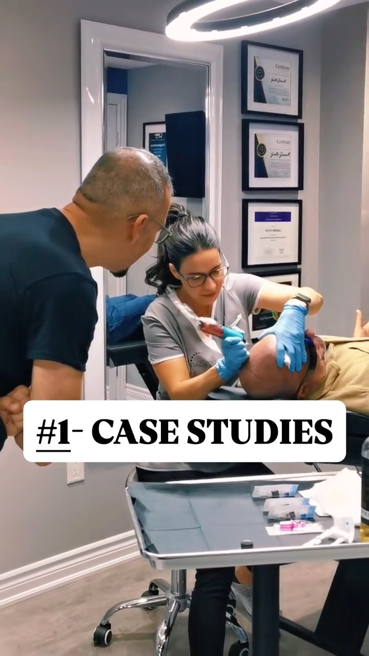 Thinking about breaking into a career that’s creative, skill-based & seriously in demand?
This is the moment to learn from our LIVE TEACHING CLINIC
Ink2Scalp Academy’s Core SMP Fundamentals Training is now open for August, and trust us — if you’ve been watching from the sidelines, this is where you jump in.
In just 3 deep & powerful days, you’ll get hands-on with real clients, master the tools of the trade, and learn what it really takes to stand out in the scalp micropigmentation profession. Whether you’re new or ready to level up, this course sets you up to launch with skill, confidence & strategy.
🔧 Here’s What You’ll Walk Away With:
🎯 A high-quality wireless SMP machine to keep
📘 Step-by-step training manual + a detailed pigment mixing guide
📦 A full set of needles — sizes 04, 06, and 08 — for every technique
🧴 Two bottles of 5PM pigment + essential aftercare products
🧑🎨 Real experience working on live models and observing actual client sessions
💼 Expert-led sessions on consultation skills, pricing, and business strategy
🧰 A pro-grade toolkit included with your training
🤝 Lifetime mentorship to support your ongoing questions
👀 We’ll be there to shadow your first client session at Ink2scalp
📸 Help to begin building your portfolio, online presence & social content
📅 August dates are open - and spots fill fast.
📲 Call/text us at (647) 424-1186 or email ink2scalp@gmail.com with any questions.
🔗 Apply now: www.ink2scalp.com/academy
#Ink2ScalpAcademy #SMPTraining #ScalpMicropigmentation #TorontoSMP #ThinkSMP #HairTattooTraining #NewCareerMove #SMPProfessionals #CosmeticTattooing #gamedaymenshealth #mensmentalhealth