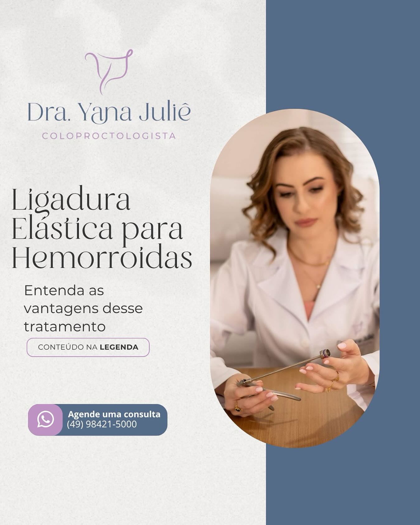 Ligadura Elástica para Hemorroidas
🤔 Você sabia que podemos realizar o tratamento das hemorroidas de forma rápida e em consultório...
A ligadura elástica é considerada um método minimamente invasivo para o tratamento das hemorroidas, e possui como vantagens a simplicidade de execução, realização em consultório, menor dor no pós, e uma RECUPERAÇÃO RÁPIDA.
Se você está sofrendo de hemorroidas, a Ligadura Elástica pode ser seu tratamento.
Não deixe o medo atrapalhar os cuidados com sua saúde, agende já sua consulta!!!
Dra. Yana Juliê Perondi
Coloproctologista
CRM: 29717 || RQE 27567
#proctochapeco #proctologistaemchapeco #hemorroidas #chapeco #saudeintestinal #ligaduraelastica