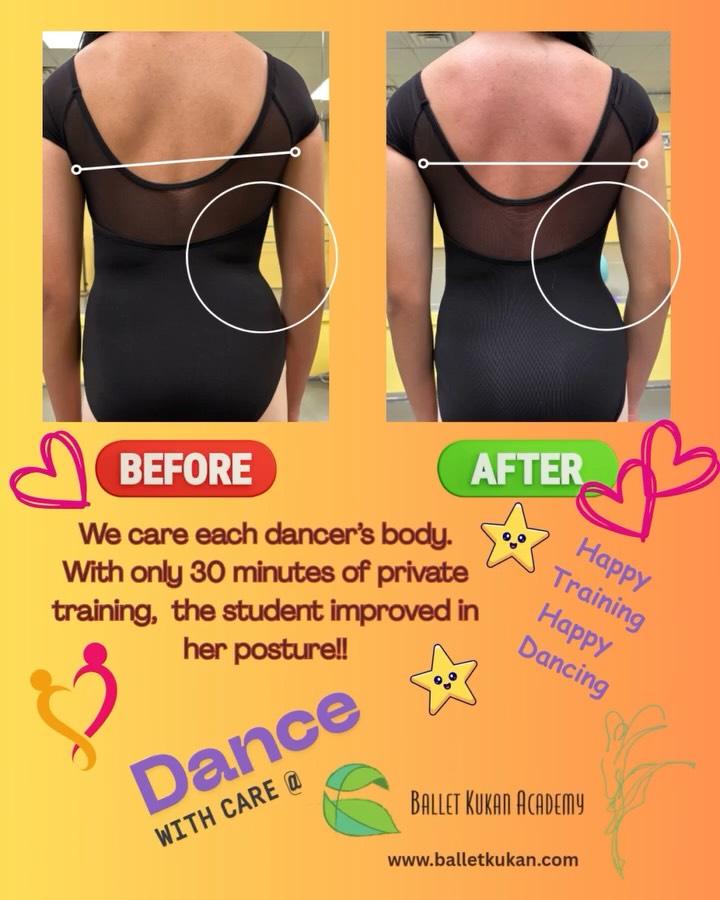 Dance training will bring a better posture. Everyone has habits and problems in their growth. Dance will help you to observe growing healthier!!