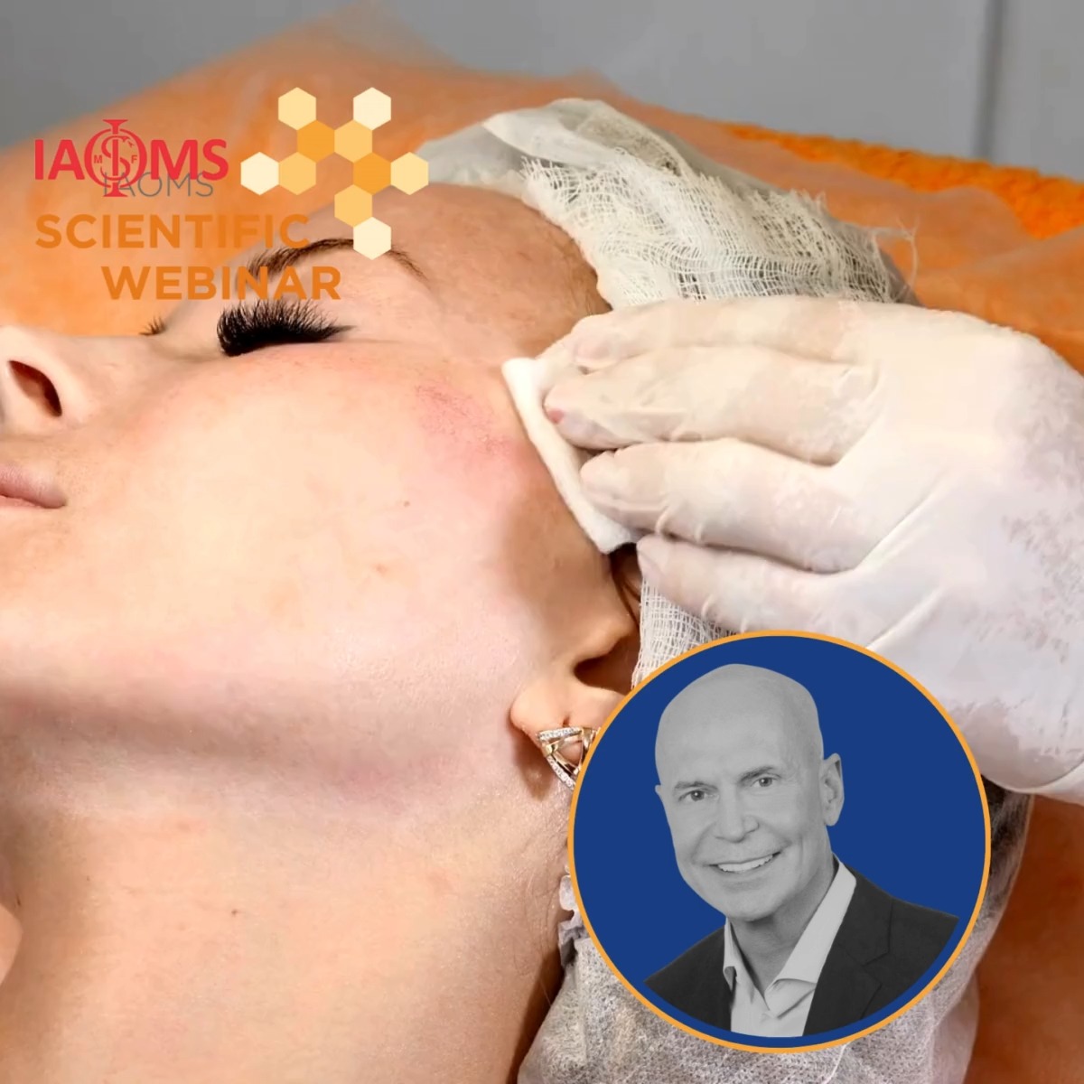 Watch and learn:
Incision placement.
SMAS strategy.
Real results.
Get cosmetic surgery pearls from the one and only Dr. Joe Niamtu in this expert-led IAOMS webinar. Available anytime on demand!
IAOMS Members: Free
Non-Members: $39.99
🔗 in bio
#CosmeticSurgery #Facelift #OMFS