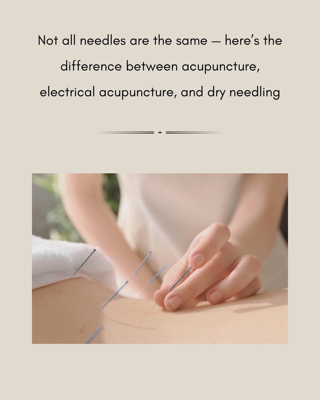 If you’ve ever wondered what sets acupuncture apart from dry needling or electrical acupuncture — here’s a quick breakdown.
🪡 Acupuncture is a foundational part of Traditional Chinese Medicine. It’s based on a rich system of meridians and energetic pathways, and aims to restore balance to the whole body — addressing not just pain, but also digestion, sleep, hormones, emotions, and more. Needles are placed with care to stimulate Qi, calm the nervous system, and support healing from within.
⚡️ Electrical acupuncture builds on this by adding a gentle current between specific needles. This enhances the effect — especially useful for stubborn pain, muscle tension, or nerve-related conditions. It helps rewire pain signals and increase circulation, often offering deeper or longer-lasting results.
🔧 Dry needling, often performed by physiotherapists, uses similar needles but is based on a Western musculoskeletal model. It focuses primarily on trigger points and muscle release, without the holistic or energetic framework of acupuncture.
All three techniques use similar tools — but the intention, training, and philosophy behind them are different. Acupuncturists are extensively trained in both the physical and energetic body, ensuring that each treatment is customized and deeply supportive of your whole system.
If you're curious about acupuncture or wondering which approach is right for you, I’d be happy to chat. Book a session and experience the difference that whole-body, heart-centered care can make.
#AcupunctureVsDryNeedling #ElectricalAcupuncture #TCMHealing #HolisticPainRelief #KnowYourModalities