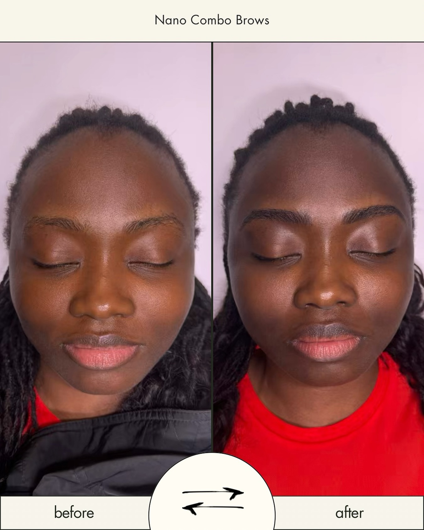 Nano Combo Brows — what does that mean?
Think of it as the perfect in-between. You get the natural, realistic look of nano hairstrokes in the front, blended seamlessly into soft powder shading through the body and tail. The brows look fuller and more defined, but never overdone.
I offer FREE brow consultations so you can see what style best suits your features before making a decision.
Here’s what I offer:
▫️Powder Brows
▫️Nano Hairstrokes
▫️Nano Combo Brows
Book your consultation today — let’s find the brows that make you feel like you, just enhanced. 🫶🏼
You can find the link in my bio
#nanobrows #seattlebrows #seattleeyebrows #seattlepmu #seattle #seattlebeauty #seattlebeautysalon #browsalon #seattlenanobrows #nanohairstrokes #pmu #cosmetictattoo #smallbusinessowner #womenownedsmallbusiness #westseattle #westseattlebusiness