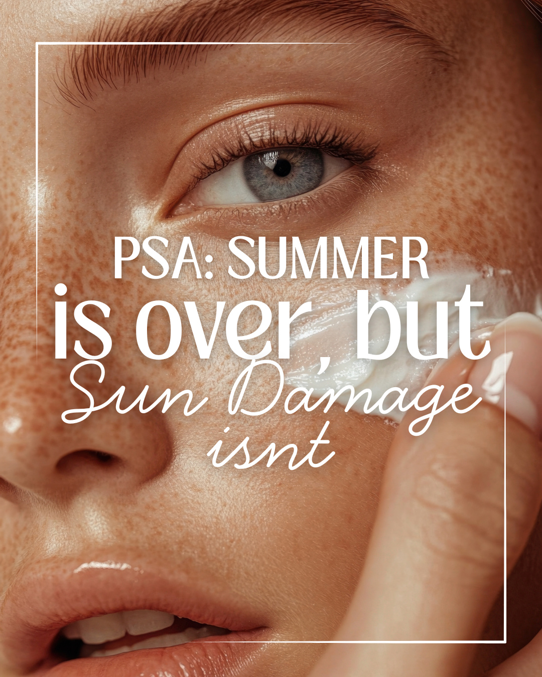☀️ Summer is over, but the sun damage isn’t! ☀️
Even though the sunny days are behind us, the effects of UV exposure can linger long after. Fine lines, dark spots, uneven texture, and premature aging are all signs of sun damage that may have built up over the summer months.
Here’s the truth: UV rays can cause long-term damage beneath the surface of your skin, even if you don’t see it right away. That’s why fall is the perfect time to start corrective treatments!
💡 Why now?
❄️ Cooler weather means less sun exposure, giving your skin the chance to heal and recover.
😎 Treatments like chemical peels and laser therapy are more effective when your skin isn’t exposed to intense UV rays.
🌟 Starting now ensures your skin is glowing and healthy by the time the holidays roll around!
Don’t let summer’s sun damage stick around—take action today! Book a consultation with us, and let’s create a personalized plan to restore your skin’s health and radiance. 🤍
📍 Frankenmuth Aesthetics