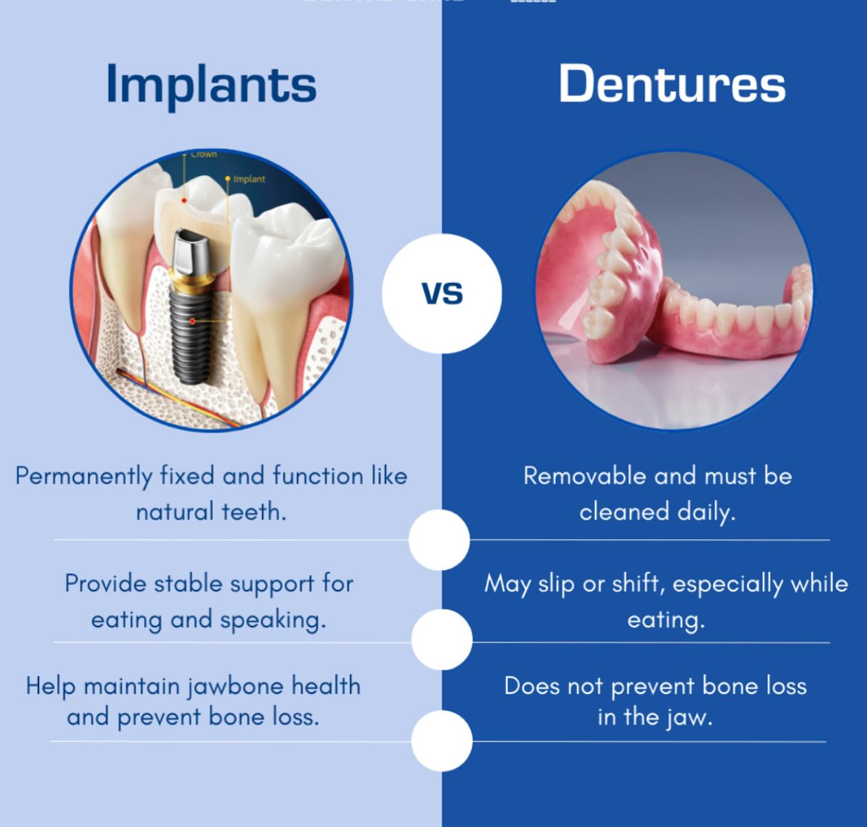 Implants vs dentures #biohorizon #bakersfielddentist #bakersfield #rezamoghbeldds