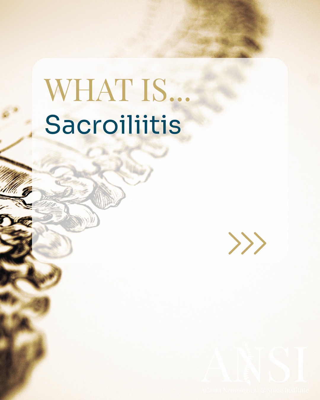 Sacroiliitis is the inflammation of one or both sacroiliac joints — where your spine meets your pelvis.
This condition can cause pain in the lower back, buttocks, and even down the legs, often worsening with prolonged standing or climbing stairs.
Treatment may include medication, physical therapy, or injections to reduce pain and inflammation.
Don’t ignore persistent low back pain — the right care can bring relief.
.
.
.
#WednesdayWisdom #ANSI #AtlantaSpineExperts