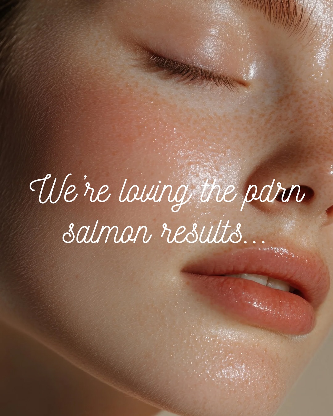 We hear you guys loud & clear… our clients are obsessed with their PDRN Salmon glow combo with microneedling 🐟✨
Healthy, radiant, plump skin is in and we’re here for it!
Have you tried it out yet? 🙂↔️
#denveresthetician #pdrn #salmonpdrn #denvermedspa #medspa #microneedling #denverlocal