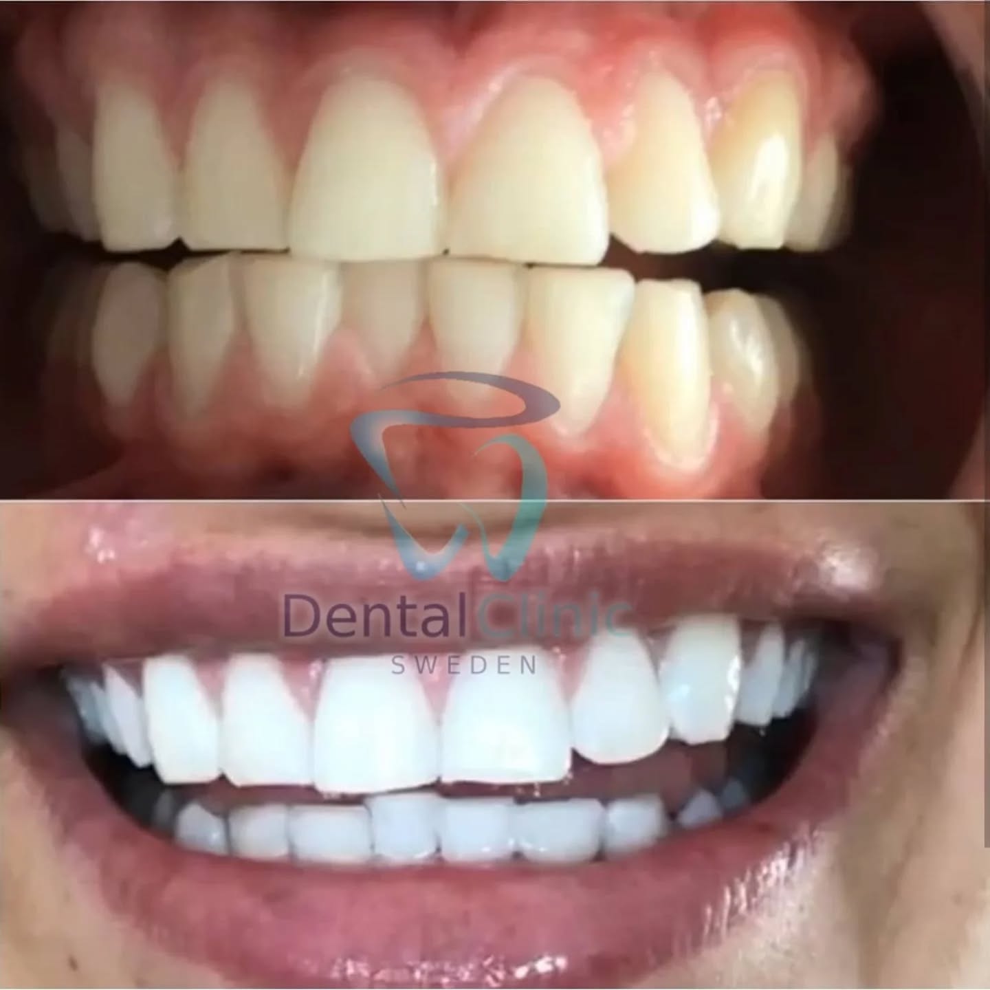 Klinik Tandblekning
ERBJUDANDE 995 KR
ONLINE TIDSBOKNING
www.DentalClinicSweden.org