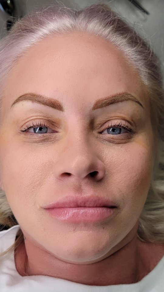 Committed to NEVER having to draw on her brows again ๐ค๐ค๐ค
#permanentmakeupstjohnscounty #permanentmakeuppontevedra #permanentmakeupstaugustine #permanentmakeupjacksonville #stayinkd #powderbrows #scarcamouflage #paramedicaltattooing #areolatattooing #stauglocals