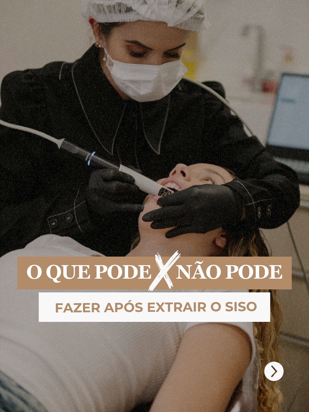 Acabou de tirar o siso e não sabe o que pode ou não pode fazer?
Essa dúvida é mais comum do que você imagina, e seguir as orientações certas faz toda a diferença na recuperação.
❌ Nada de líquidos quentes
✅ Prefira opções frias, como sorvete ou sucos gelados
❌ Evite esforço físico
✅ Invista em repouso e descanso
❌ Não mexa no local da cirurgia
✅ Siga à risca as recomendações do dentista
❌ Esqueça cigarro e álcool
✅ Hidrate-se bem e cuide da sua saúde
Cada organismo reage de um jeito. Por isso, o mais importante é ter acompanhamento profissional para garantir uma cicatrização tranquila e segura.
📍 Atendimento em Belo Horizonte.
👉 Link na bio para agendar sua avaliação.
#siso #extraçãodesisobh #dentistabh #dentistacirurgiãbh