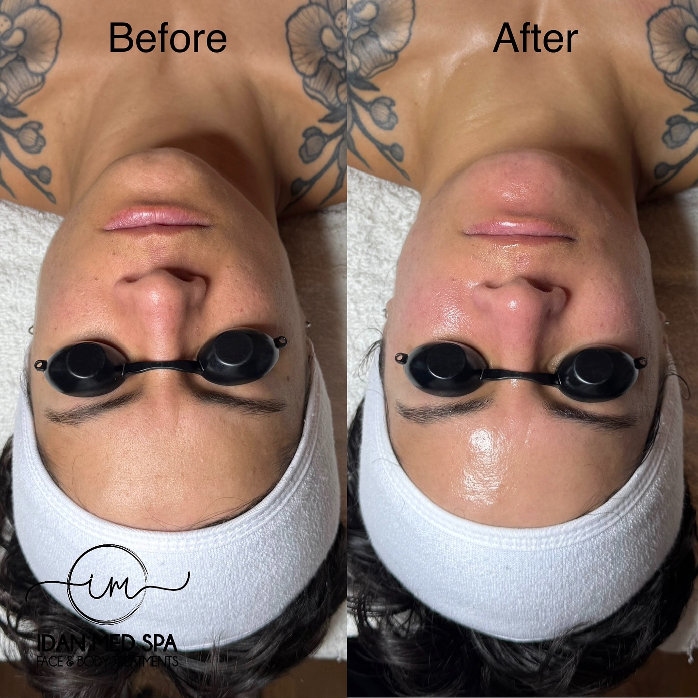 The glow speaks for itself!
Our Triple Layer Facial works deep to hydrate, smooth, and brighten your skin revealing that glass-skin finish everyone loves.
Ready to glow? Book your treatment today ✨
📍Encino & San Francisco
#idanmedspa #triplelayerfacial #hydrationboost #glowingskin