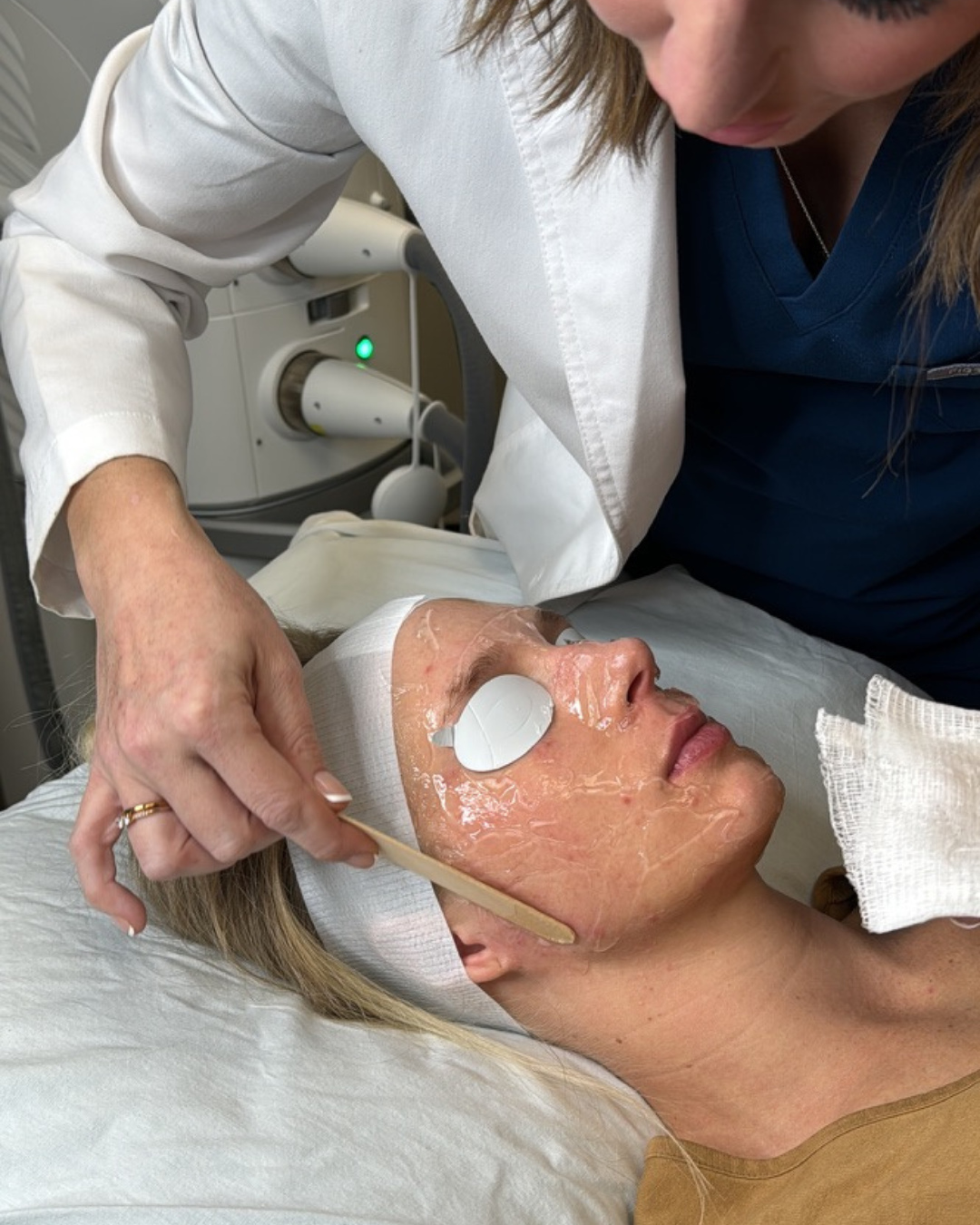Two treatments, one session, total skin refresh. ✨
That's the Stellar M22™ secret.
Get ready to meet your best skin yet. We combine two powerful treatments to give you comprehensive results with little to no downtime.
☀️ Say goodbye to sun damage, redness, and pigmentation.
😊 Smooth out uneven texture and fine lines.
🌟 Reveal a brighter, more even-toned complexion.
How does it work? We use a "Photofabulous" approach! First, IPL targets and corrects discoloration and redness. Then, ResurFX works its magic as a non-ablative fractional laser, stimulating new collagen growth to improve texture and fine lines from the inside out.
Our patients are loving their results, often seeing visibly brighter and smoother skin in just 3-5 sessions. It’s the ultimate non-invasive glow-up.
Ready for your transformation? We have limited appointments available. Secure your spot by tapping the link in our bio to book a consultation!
