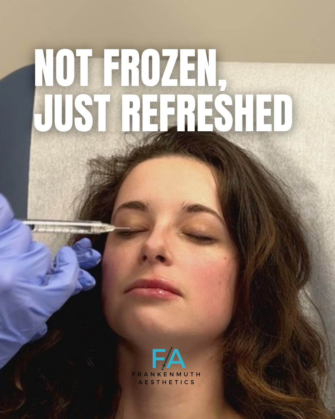Not frozen, just refreshed. That's the new standard in injectables.
Forget everything you think you know about injectables. Today’s approach is all about subtle enhancements and celebrating your unique beauty, not changing it.
What can a personalized treatment plan do?
😉 Soften expression lines for a smoother, well-rested look.
✨ Define and contour cheeks or jawline for balanced structure.
💋 Add beautiful, natural-looking hydration to your lips.
🌟 Achieve an inner glow with Skinvive's hydrating microdroplet technique.
Our philosophy is simple: custom is always better. It all starts with a thorough assessment of your facial anatomy and goals. From there, we create a bespoke dosing and treatment plan designed to deliver natural, elegant results.
Your safety is our priority. We conduct a full medical assessment before any treatment. Keep in mind that temporary swelling or bruising can be a normal part of the process.
Ready for a consultation? We have a few introductory spots open for new clients. Tap the link in our bio to book your appointment.