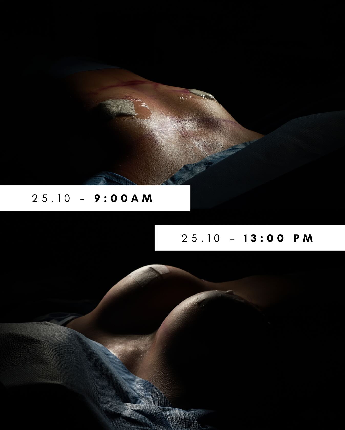 Ontem entregamos mais uma cirurgia simplesmente esplêndida 😊✨ O resultado ficou lindo — exatamente como sonhado! Agradecemos imensamente pela confiança e por nos permitir fazer parte desse momento tão especial 🤍