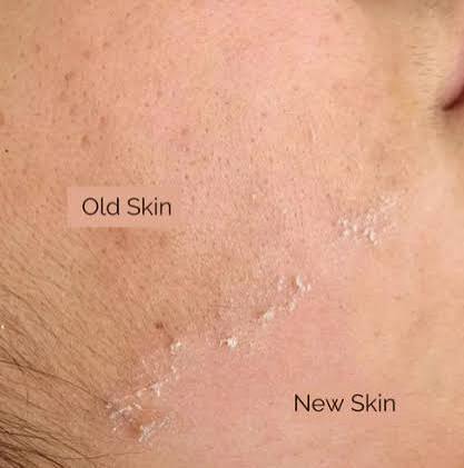 ✨ Smooth. Glowy. Makeup-ready. ✨
This is your sign to book a dermaplaning facial — the secret to baby-soft skin that feels as good as it looks! 💆♀️
Dermaplaning gently removes peach fuzz + dead skin buildup, helping your skincare absorb better and your makeup glide on like silk. Say goodbye to dull, textured skin and hello to that fresh-faced glow everyone notices ✨
Your skin will thank you 💖
#dermaplaning #myrtlebeach #myrtlebeachwellness #glowingskingoals #smoothskin #transformationtuesdays #beforeandafter #medspalife #medspamagic #healthyfromtheinsideout #exfolation #dermaplane #dermaplaneglow