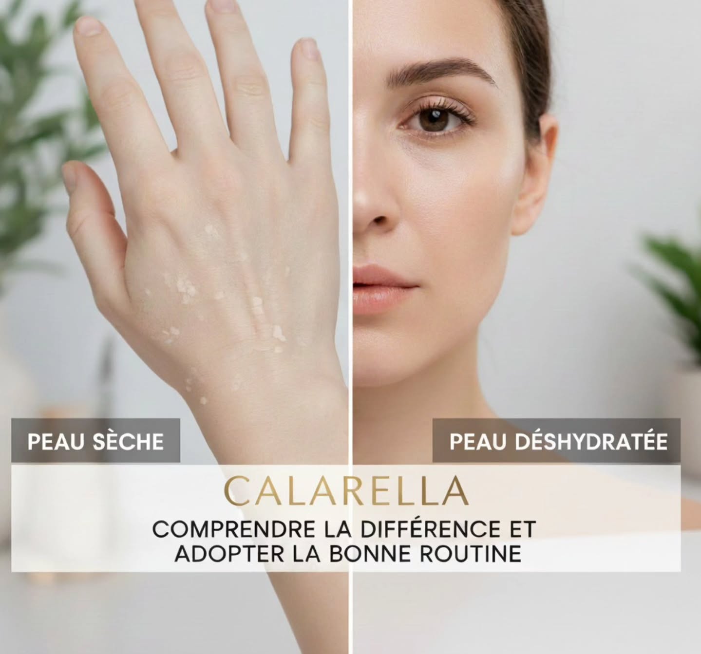 Peau sèche ou peau déshydratée ? Et pourquoi ça change tout !
👉 Dans notre nouvel article, on fait le point sur deux états bien distincts :
• La peau sèche : un manque de lipides, un type de peau à part entière.
• La peau déshydratée : un manque d’eau, un état temporaire qui peut toucher tous les types de peau.
Parce qu’une bonne routine commence par une bonne compréhension !
💧 Nos conseils Calarella pour rééquilibrer naturellement
• Pour hydrater : pensez à l’eau + activer la capacité de la peau à la retenir.
• Pour nourrir : apportez des lipides pour restaurer le film hydrolipidique et le confort cutané.
• Et surtout : regardez si votre peau n’est pas à la fois sèche ET déshydratée — à ce moment, c’est une routine combinée qui fait la différence.
🌸 Pourquoi choisir Calarella ?
Née en Corse, notre marque mise sur des soins naturels, sensoriels, à base d’ingrédients méditerranéens puissants : immortelle, châtaignier, myrte, etc. Pour respecter votre peau et la nature.
📖 Curieux·se ? Lisez l’article complet via le lien dans la bio — et transformez votre routine beauté en alliée de votre peau 💚
#Calarella #PeauSèche #PeauDéshydratée #RoutineBeauté #SoinsNaturels #Skincare #Hydratation #Nourrissement #MadeInCorsica
