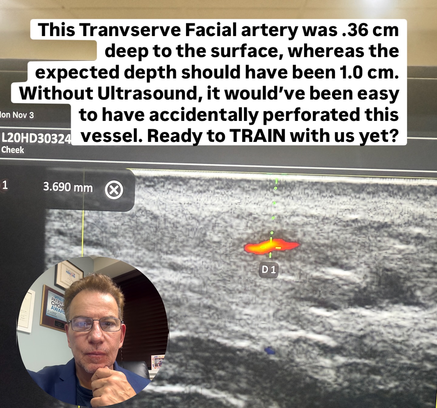 We are offering exclusive 1:1 and 2:1 aesthetic training in New York and in Michigan during the months of December, January and February. This is only for physicians, nurses and PAs. Our focus is on Botox, dermal, fillers, and facial ultrasound for aesthetic procedures. We also have training on GLP-1 and the world of anti-aging. There is no hype. We don’t push products. But we will educate you with the actual scientific literature to help you provide the best service for the people that trust you the most. You have our word on that! DM if interested in our training. #Botox#AestheticTraining #juvederm #dysport #restylane #claruis #ultrasound #glp1 #weightloss #antiaging