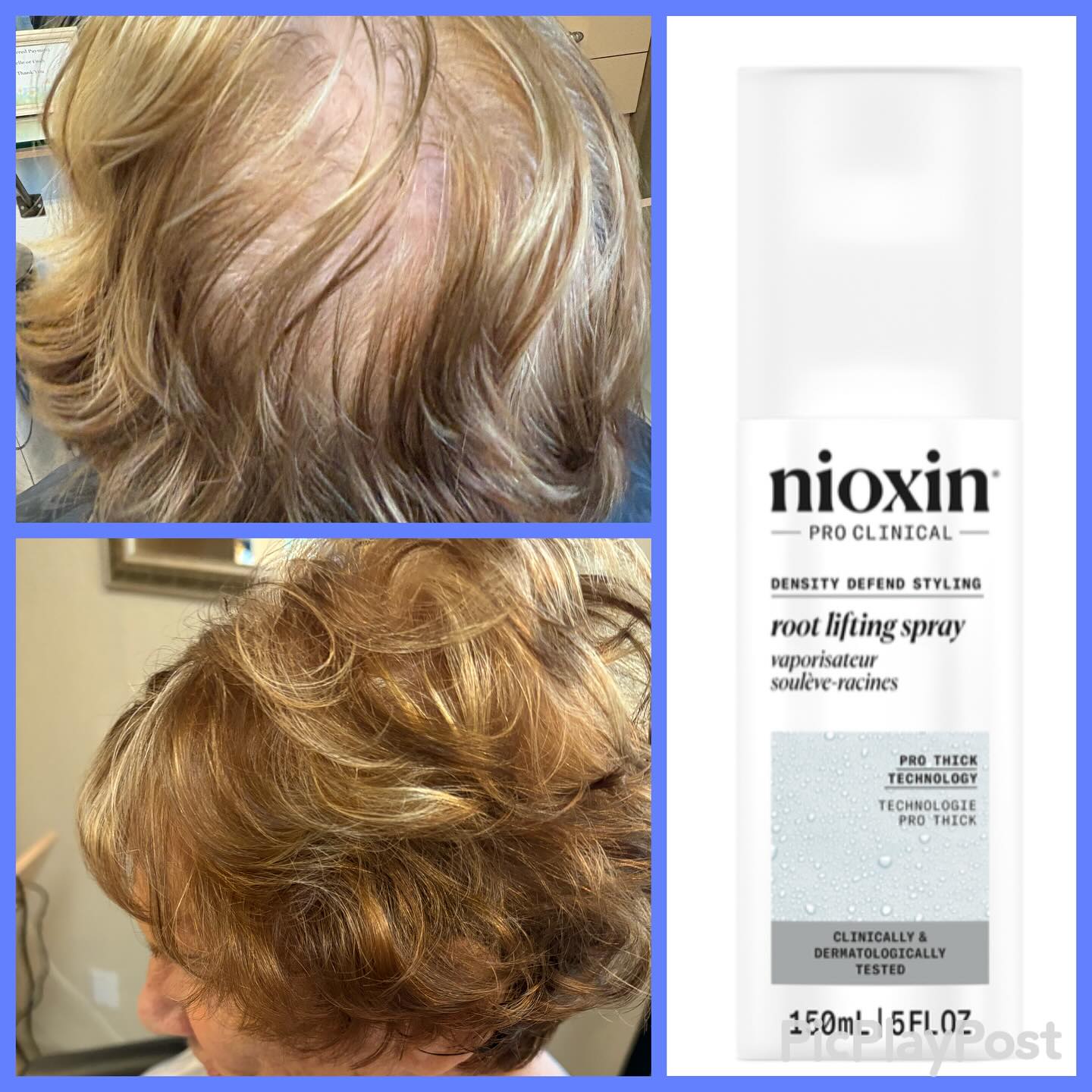 Fine hair? No problem.