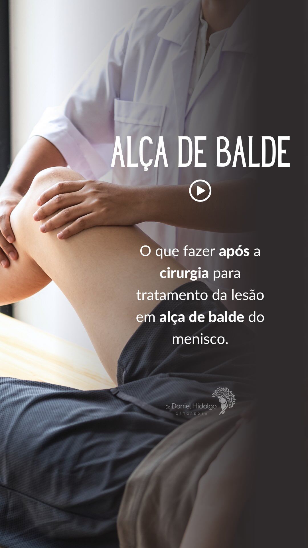 A recuperação após a cirurgia para tratar a lesão em alça de balde do menisco exige atenção, paciência e um protocolo bem estruturado. 🦵⚙️
Nos primeiros dias, o foco é controlar o inchaço ❄️, aliviar a dor 💊 e proteger a sutura do menisco. A mobilidade do joelho é liberada de forma progressiva, sempre respeitando o tipo de reparo realizado.
Em muitos casos, a carga no membro operado também é limitada nas primeiras semanas, e o uso de muletas faz parte da rotina inicial. 🩼
Com o avanço da fisioterapia, o objetivo é recuperar força, controle muscular e movimento, preparando o paciente para retornar às suas atividades — inclusive esportivas — com segurança. 🏃♂️💪
Cada caso é único, e o acompanhamento próximo faz toda a diferença no resultado final. ✔️
⸻
Dr. Daniel Hidalgo – Médico Ortopedista
CRM-SP 137.057 | RQE 41.112
Membro da Sociedade Brasileira de Ortopedia e Traumatologia (SBOT)
Membro da Sociedade Brasileira de Cirurgia do Joelho (SBCJ)
⸻
#ortopedia #lesaodomenisco #menisco #alçadebalde #cirurgiadomenisco #joelho #cirurgiadojoelho #sutura #meniscalrepair #savethemeniscus #recuperacao #fisioterapia #saude #medicinaesportiva #drdanielhidalgo
