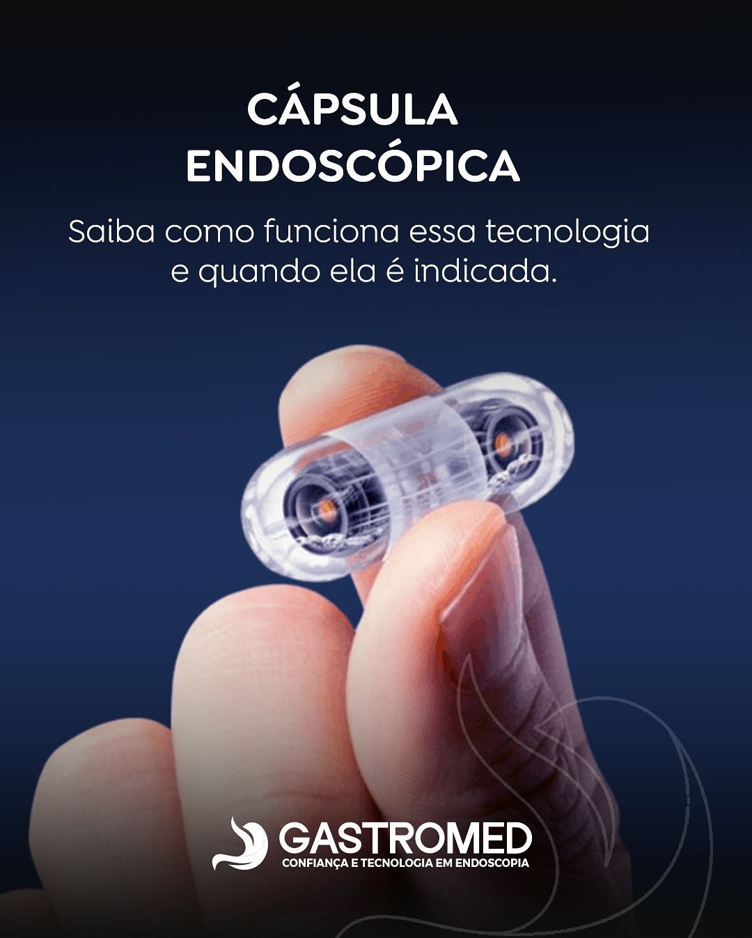 Cápsula Endoscópica: tecnologia avançada para enxergar onde outros exames não chegam.
A cápsula endoscópica é um exame moderno e minimamente invasivo que permite avaliar, em detalhe, o intestino delgado — uma região de difícil acesso pelos métodos endoscópicos tradicionais.
O paciente engole uma pequena cápsula com microcâmeras, que registra imagens durante todo o trajeto pelo trato digestivo. Essas imagens são armazenadas em um gravador e analisadas pelo médico, ajudando a identificar sangramentos ocultos, inflamações, pólipos, tumores e outras alterações.
Por ser indolor, não invasivo e sem necessidade de sedação, o exame oferece conforto ao paciente, sem abrir mão da qualidade diagnóstica.
💙 Na Gastromed Erechim, a cápsula endoscópica é utilizada com protocolos rigorosos e equipe especializada, garantindo segurança, eficiência e precisão na investigação do intestino delgado.
#GastromedErechim #CapsulaEndoscopica #Gastroenterologia #SaudeDigestiva #DiagnosticoAvançado #intestinodelgado