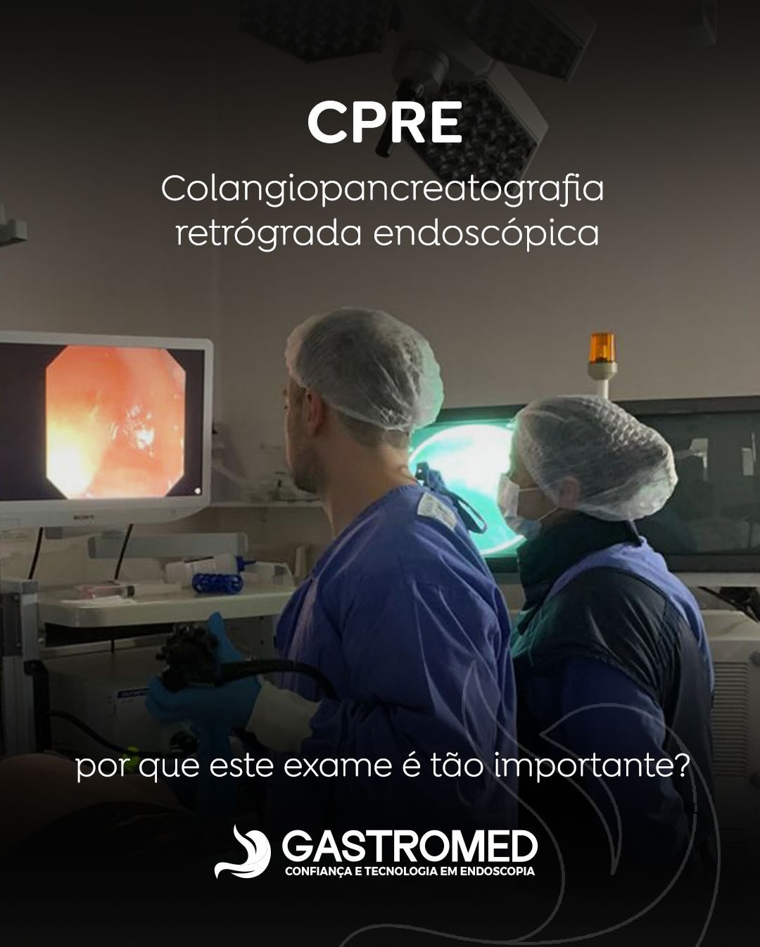 CPRE: exame fundamental no diagnóstico e tratamento das vias biliares e do pâncreas.
A CPRE (colangiopancreatografia retrógrada endoscópica) é um procedimento especializado que permite avaliar, com precisão, as vias biliares e o ducto pancreático, estruturas essenciais para o funcionamento do sistema digestivo.
Por meio da combinação de endoscopia e fluoroscopia (raio-X), a CPRE possibilita identificar obstruções, estreitamentos, cálculos e outras alterações relevantes. Em muitos casos, além de esclarecer o diagnóstico, o exame também permite o tratamento na mesma sessão, por meio de técnicas como esfincterotomia, remoção de cálculos e colocação de próteses (stents).
A CPRE tem papel central no manejo de condições como coledocolitíase (pedras na via biliar principal), icterícia obstrutiva, estenoses biliares e algumas doenças pancreáticas, contribuindo para aliviar sintomas importantes, reduzir complicações e orientar a melhor conduta terapêutica.
💙 Na Gastromed Erechim, a CPRE é realizada em ambiente hospitalar, com equipe especializada em endoscopia terapêutica e protocolos rigorosos de segurança, oferecendo cuidado técnico e humanizado aos pacientes com doenças das vias biliares e do pâncreas.
#GastromedErechim #CPRE #EndoscopiaTerapêutica #Gastroenterologia #SaúdeDigestiva #ViasBiliares #pâncreas