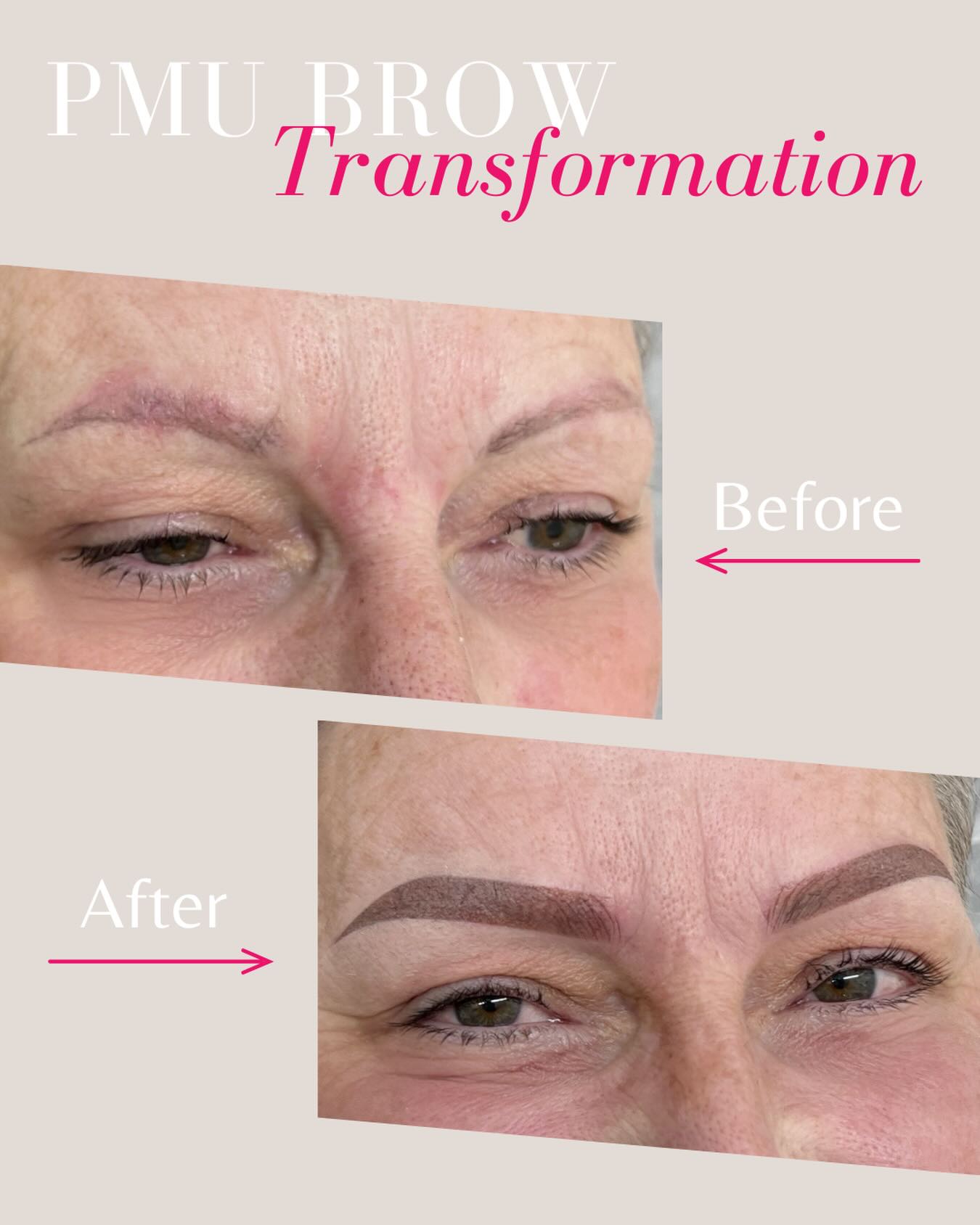 A customized PMU design can lift the eyes, create symmetry and bring back the youthful fullness we lose over time. Giving that natural confidence that only #LavoomSalonYYC can make possible💕
•
#YYCBeauty #CalgaryBrows #CalgaryLashes #BeautySalonYYC #BeautyInspo